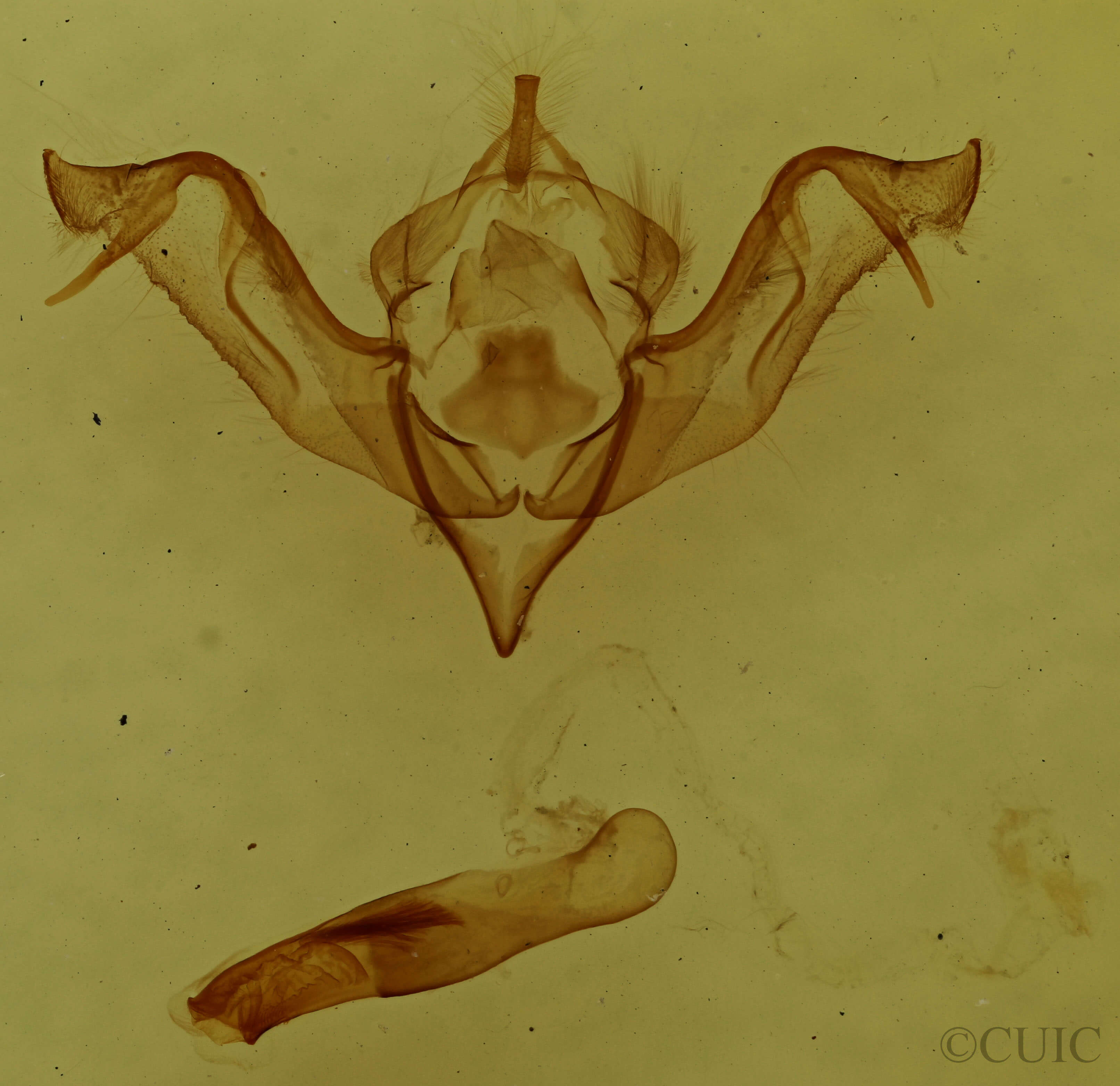 genitalia view of adult Eupsilia tristigmata