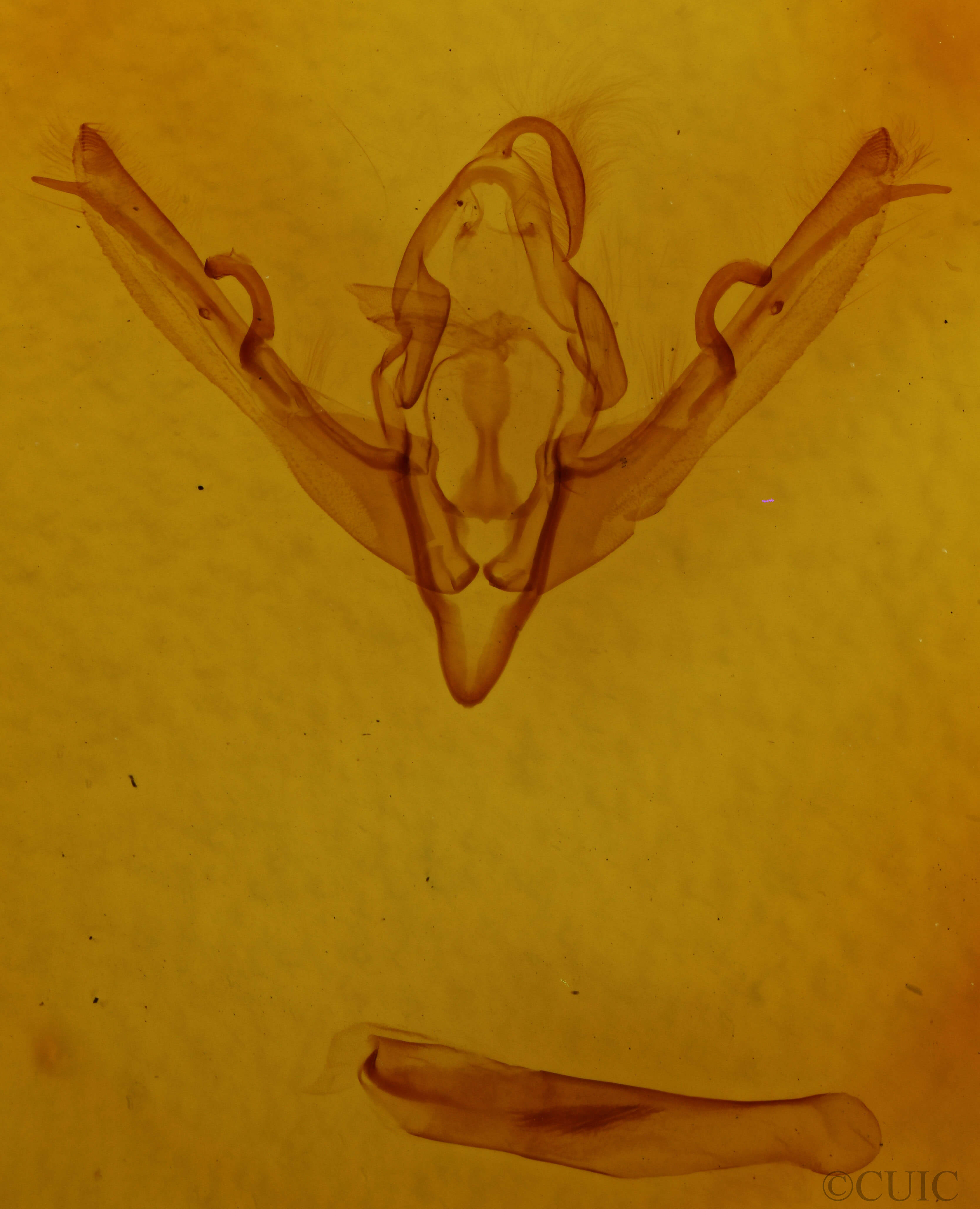genitalia view of adult Lithophane signosa