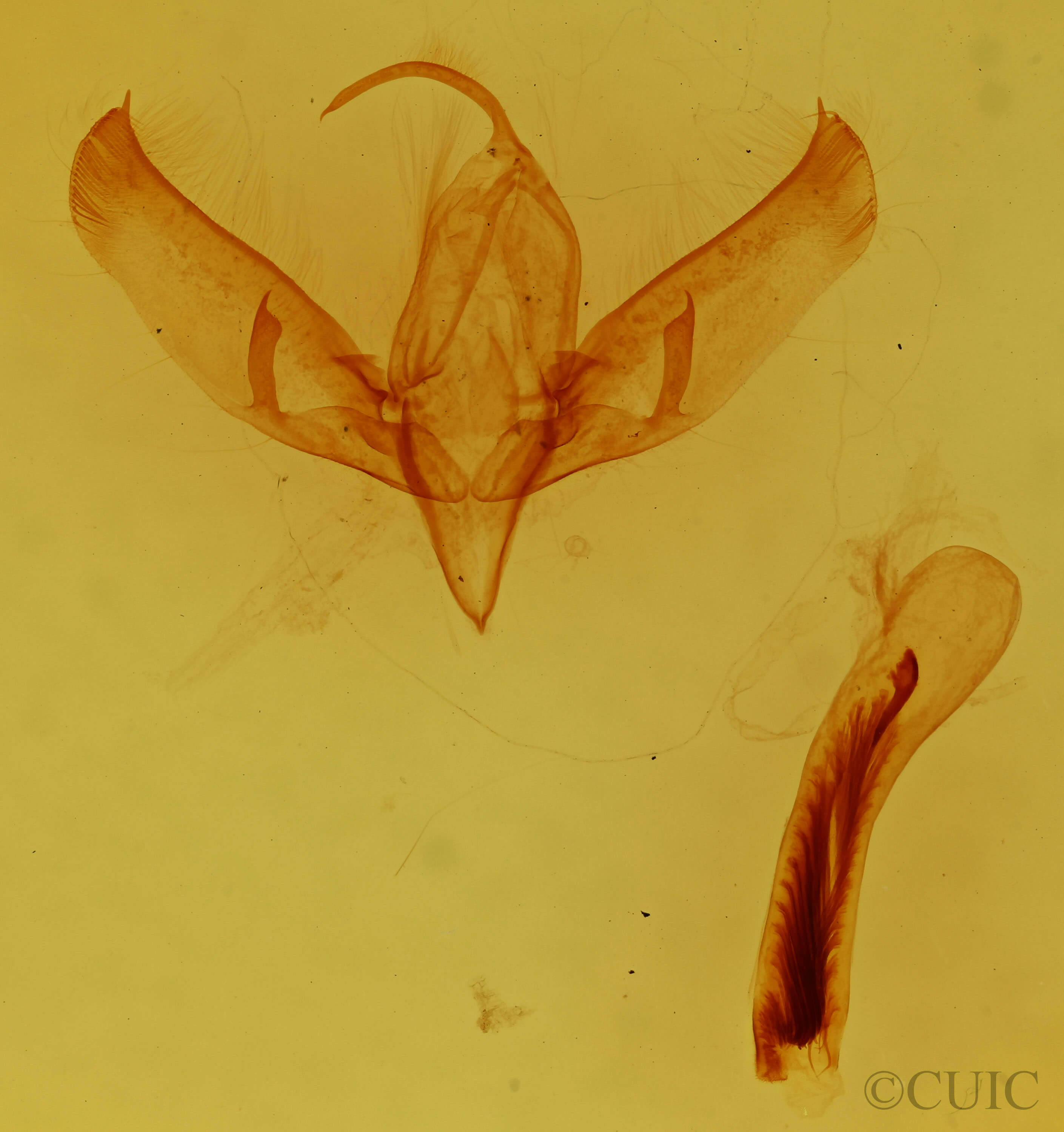 genitalia view of adult Sympistis badistriga