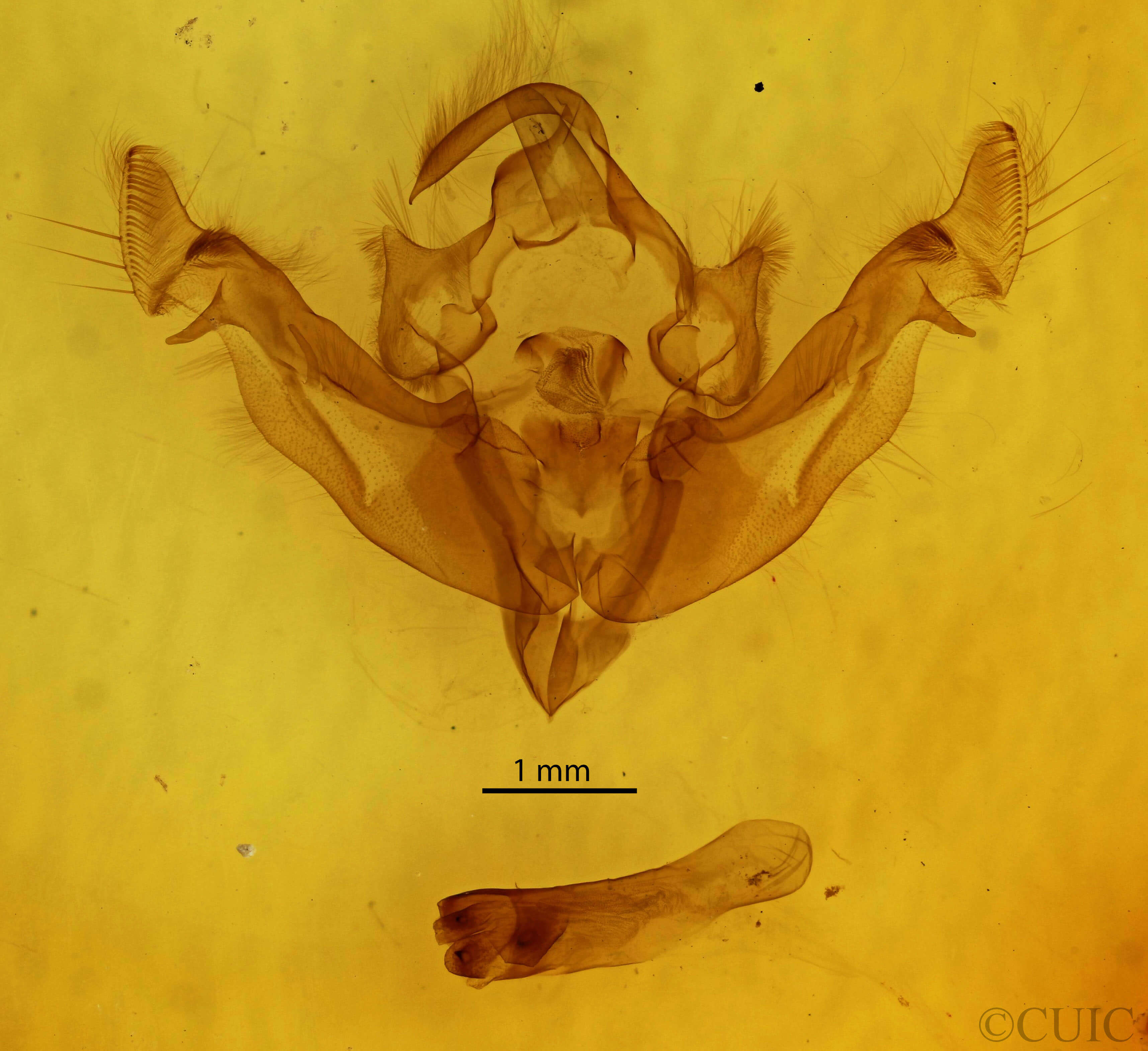 genitalia view of adult Apamea niveivenosa