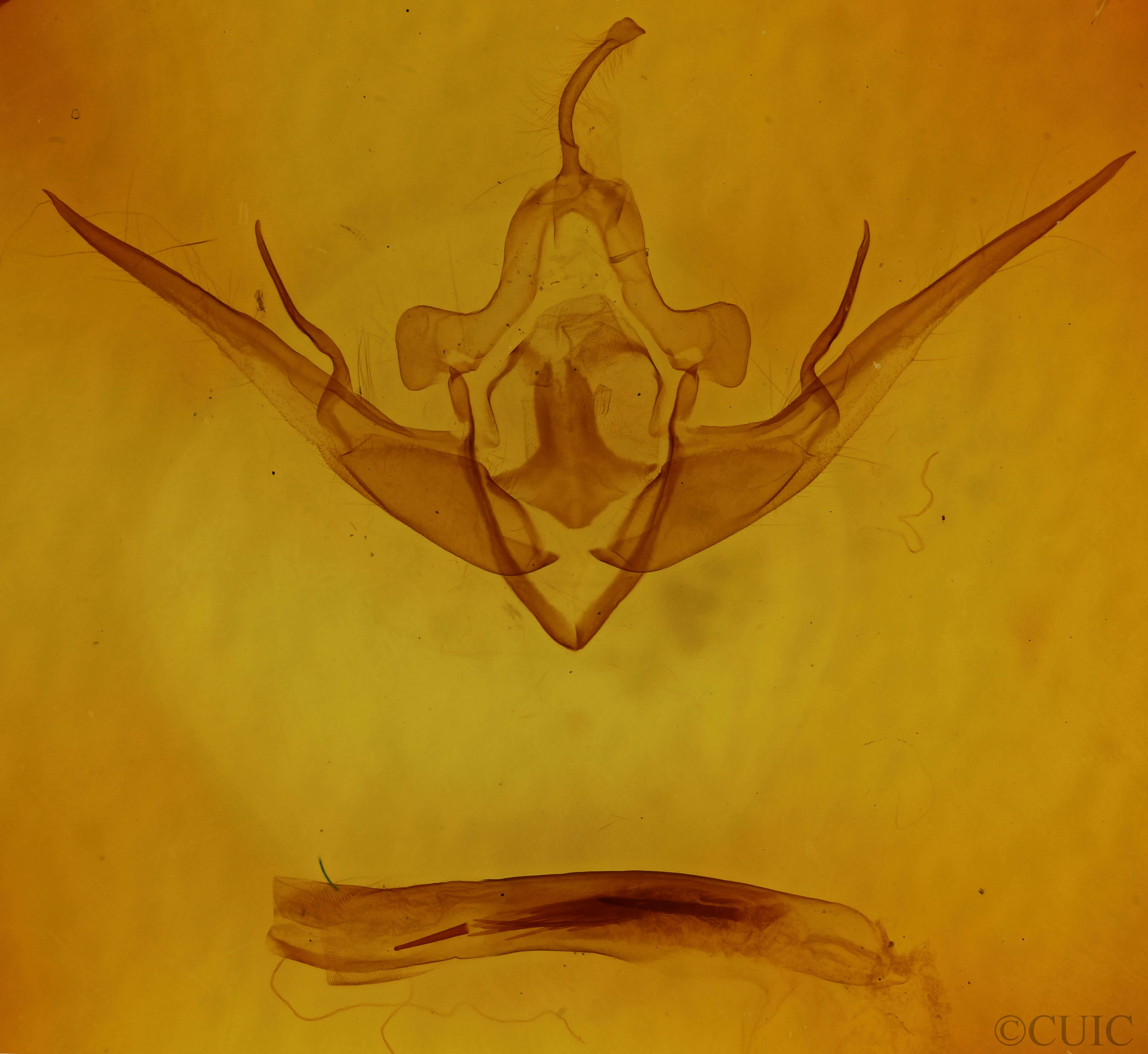 genitalia view of adult Conistra ligula