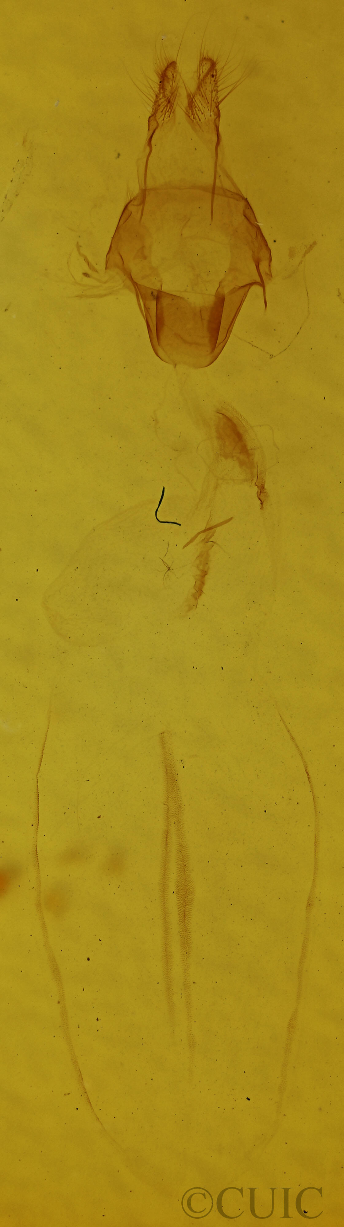 genitalia view of adult Eupsilia vinulenta