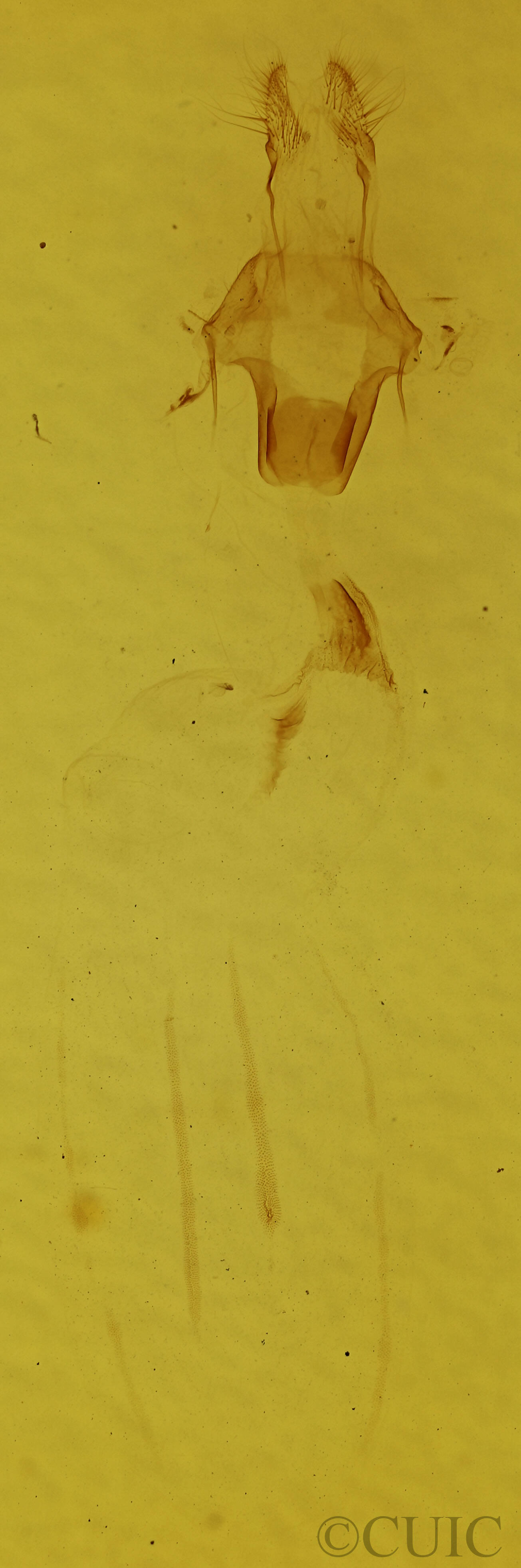 genitalia view of adult Eupsilia vinulenta