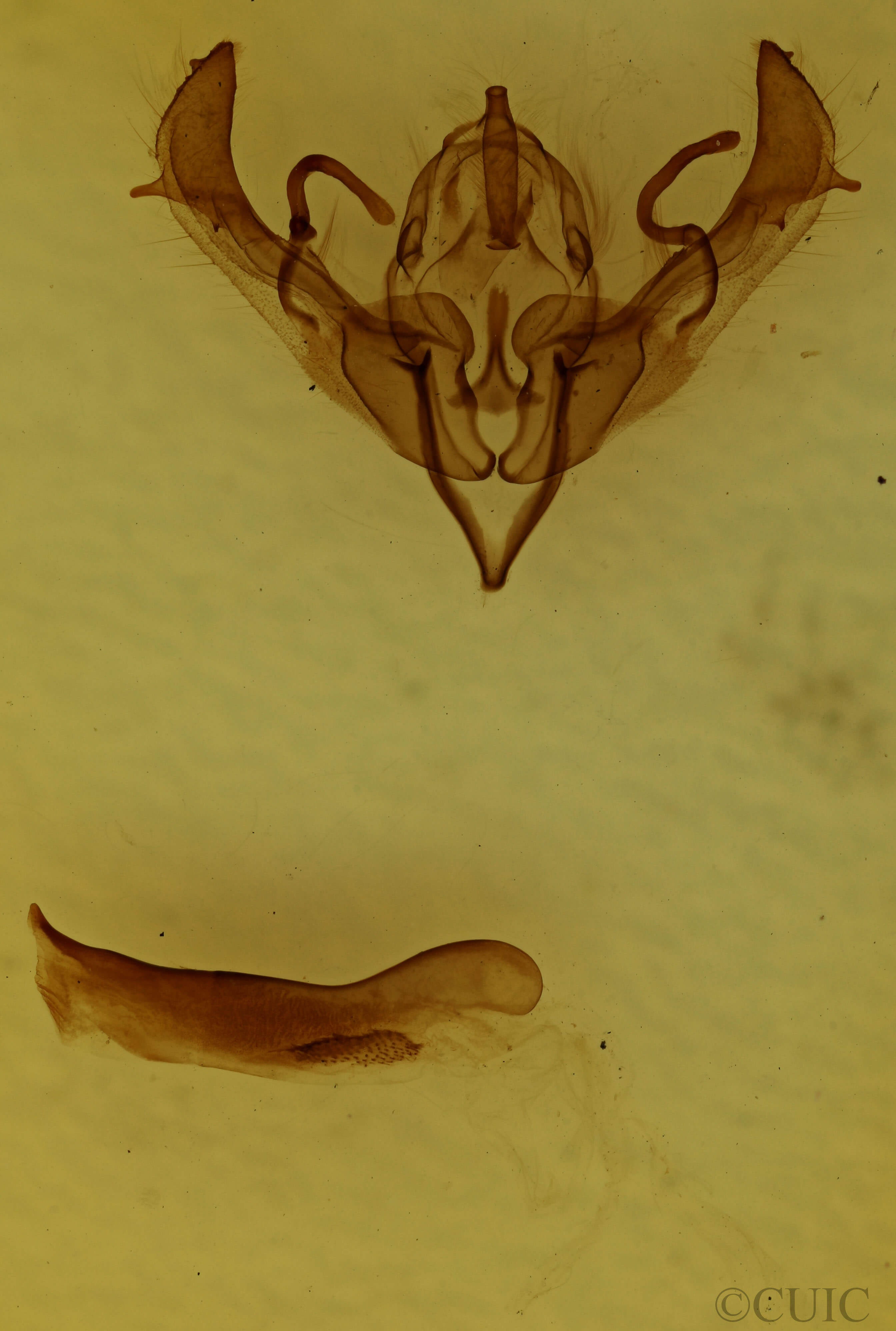 genitalia view of adult Lithophane contenta