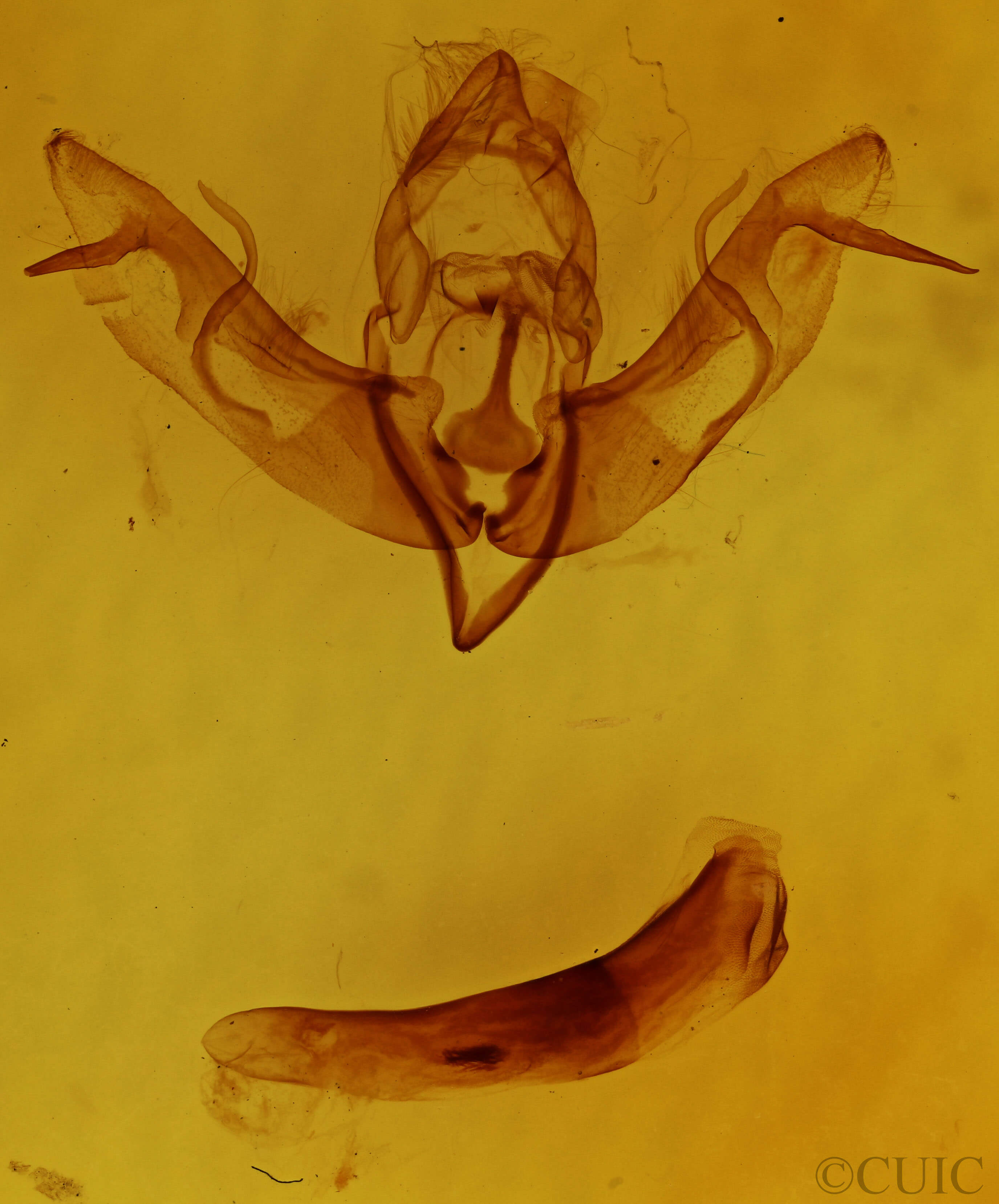 genitalia view of adult Lithophane ornitopus