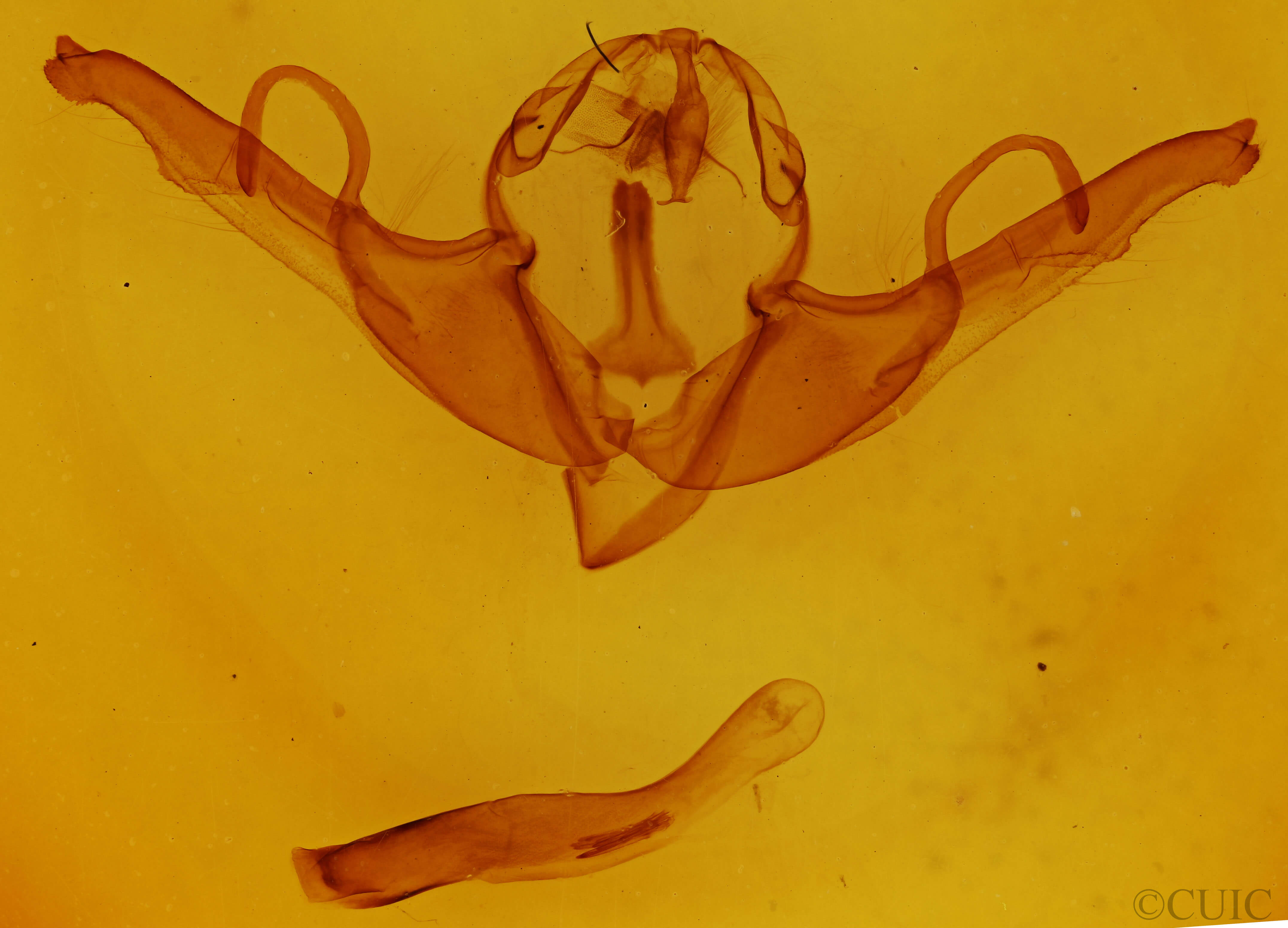 genitalia view of adult Lithophane unimoda