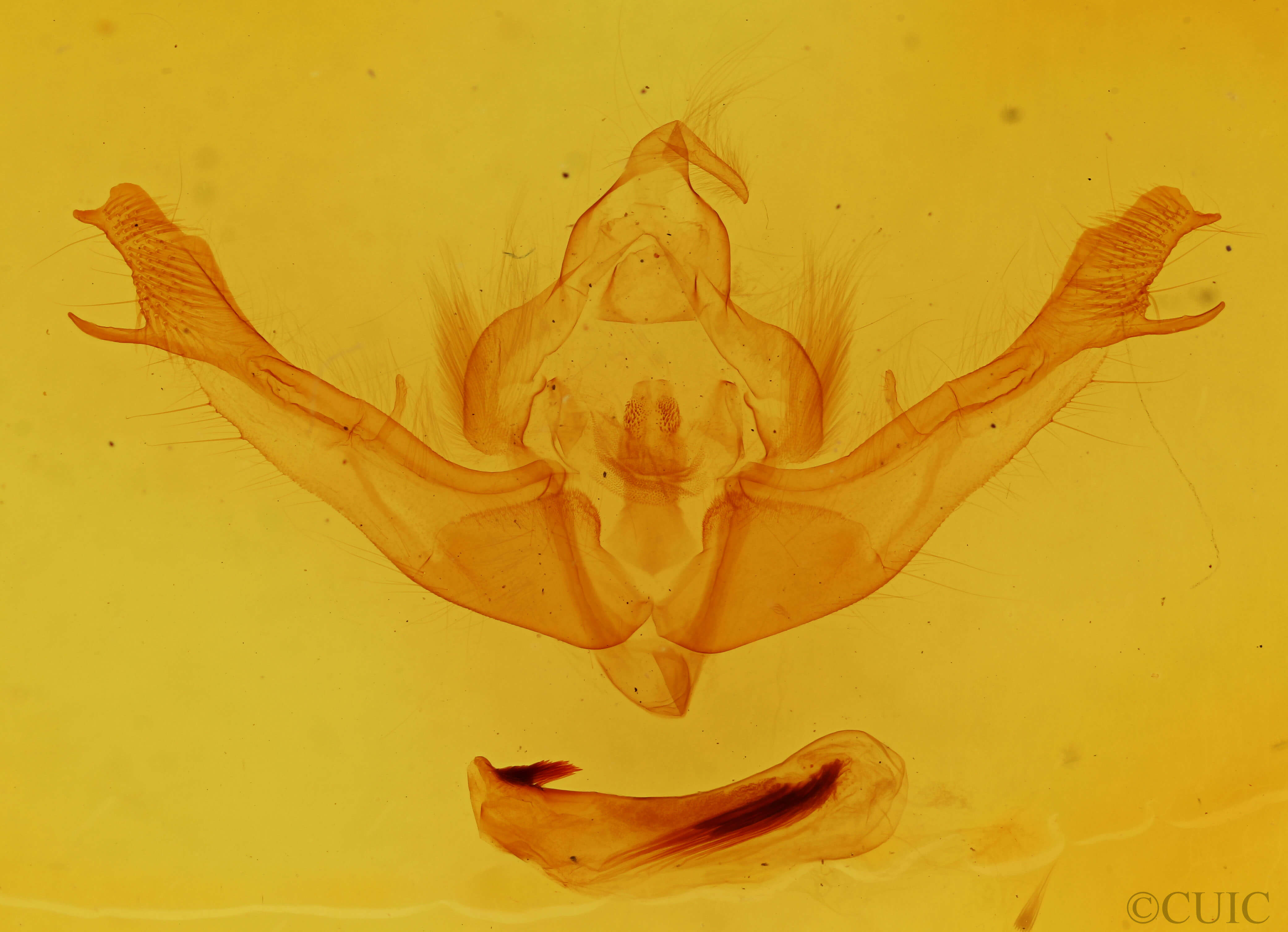 genitalia view of adult Polymixis flavicincta