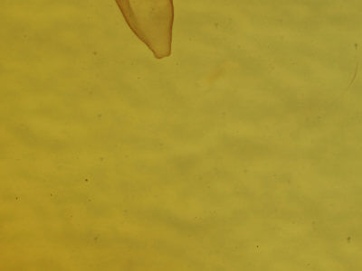 genitalia view of adult Renia adspergillus