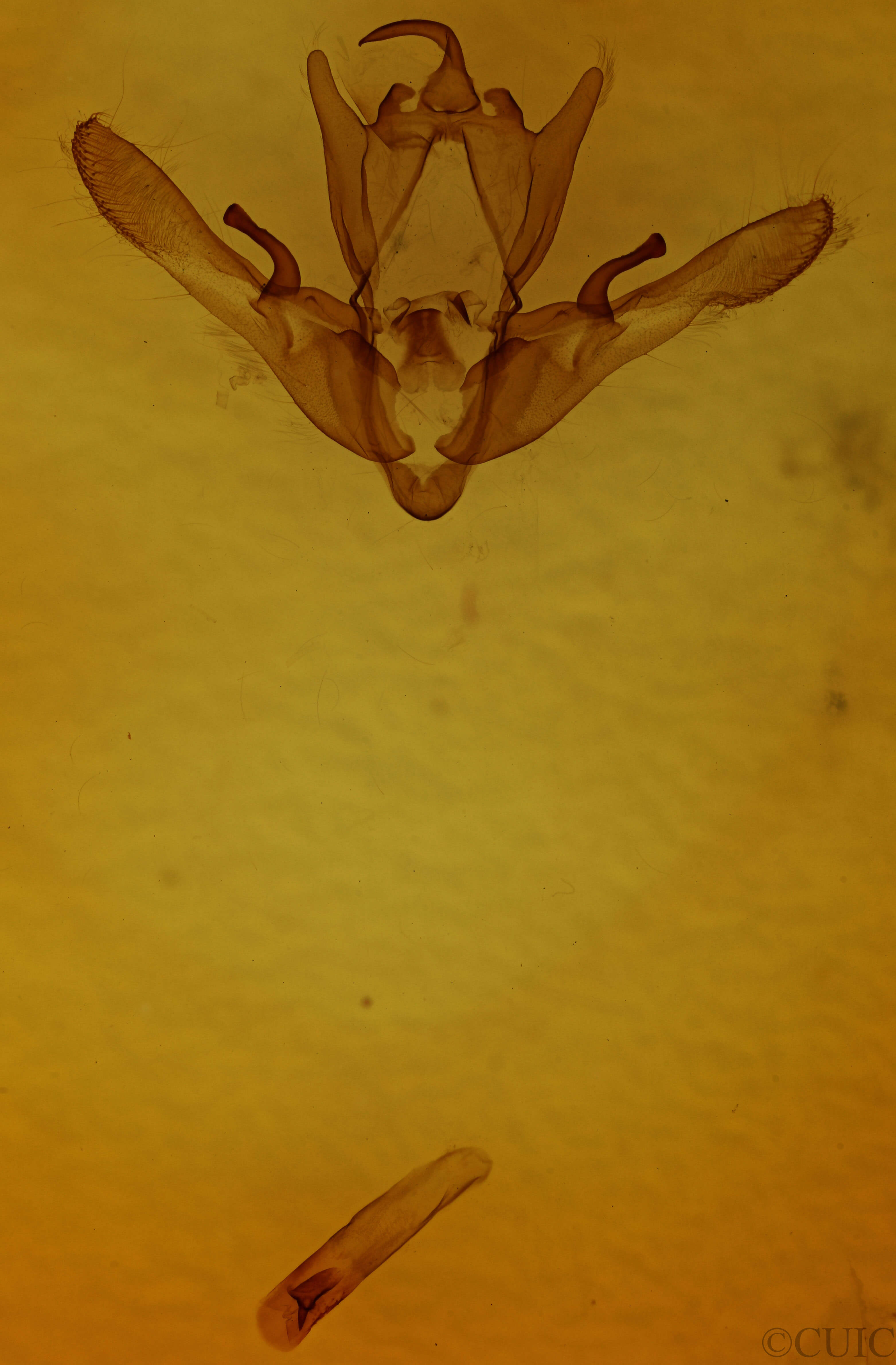 genitalia view of adult Enargia decolor