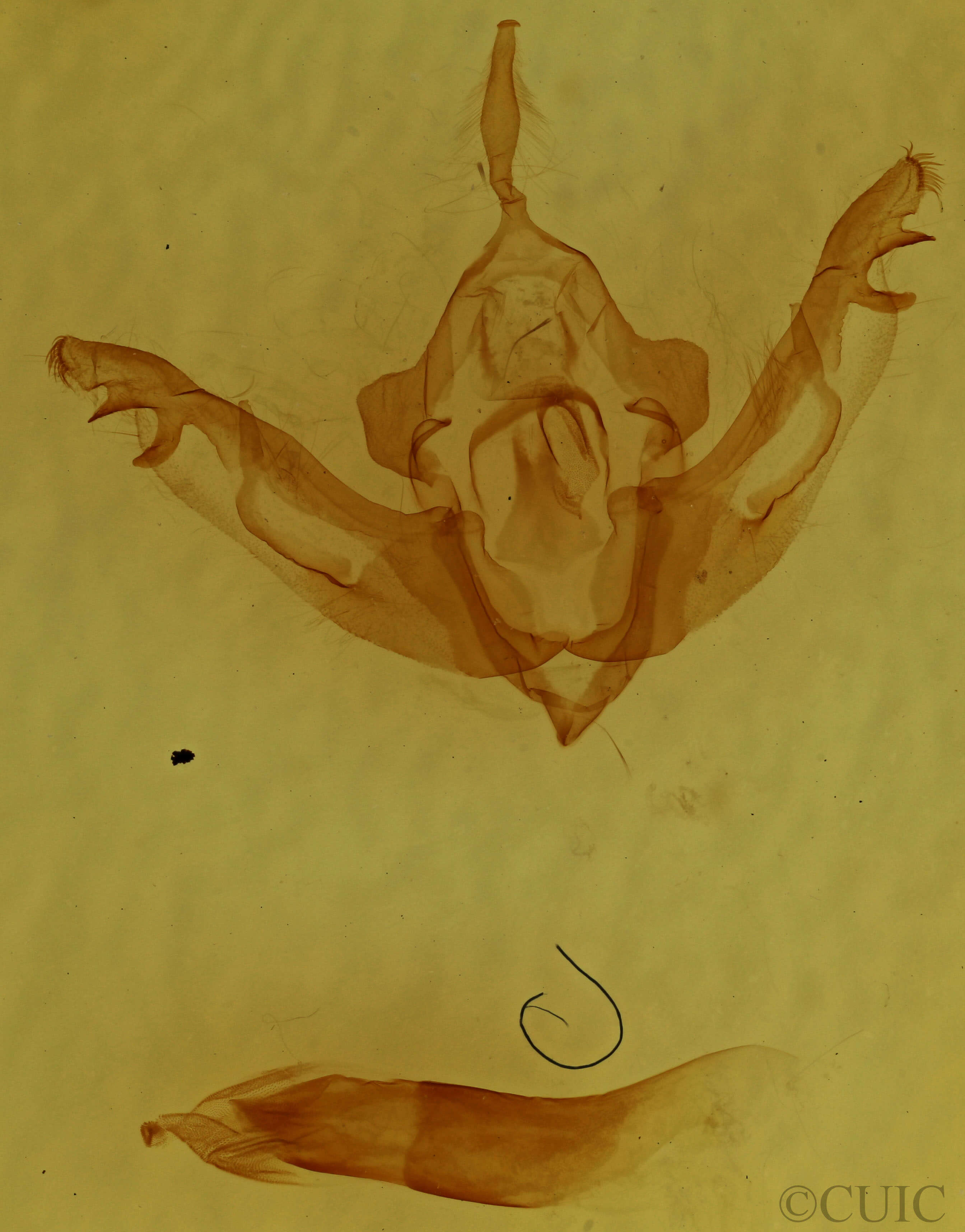 genitalia view of adult Lithophane pexata