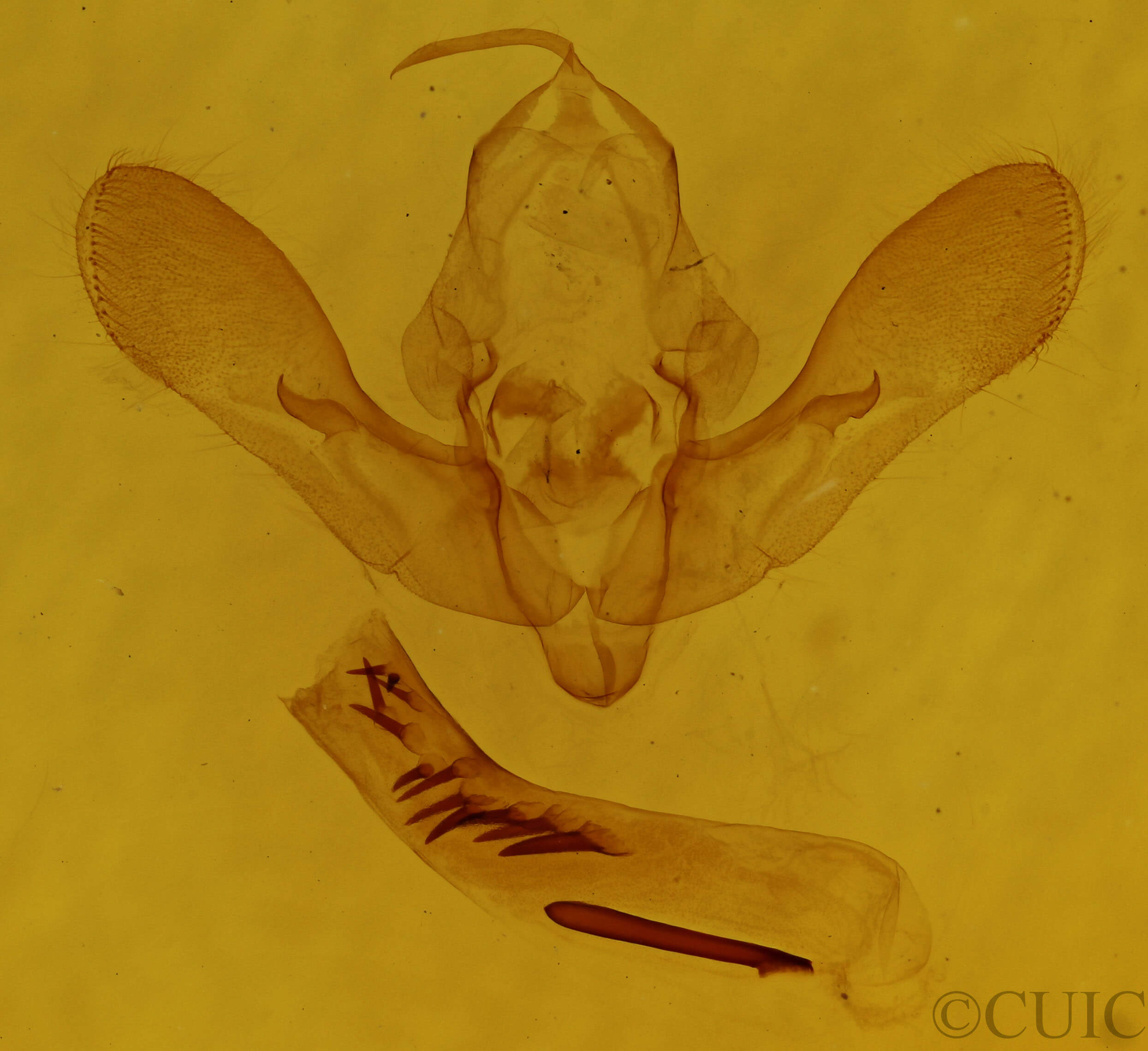 genitalia view of adult Zotheca tranquilla