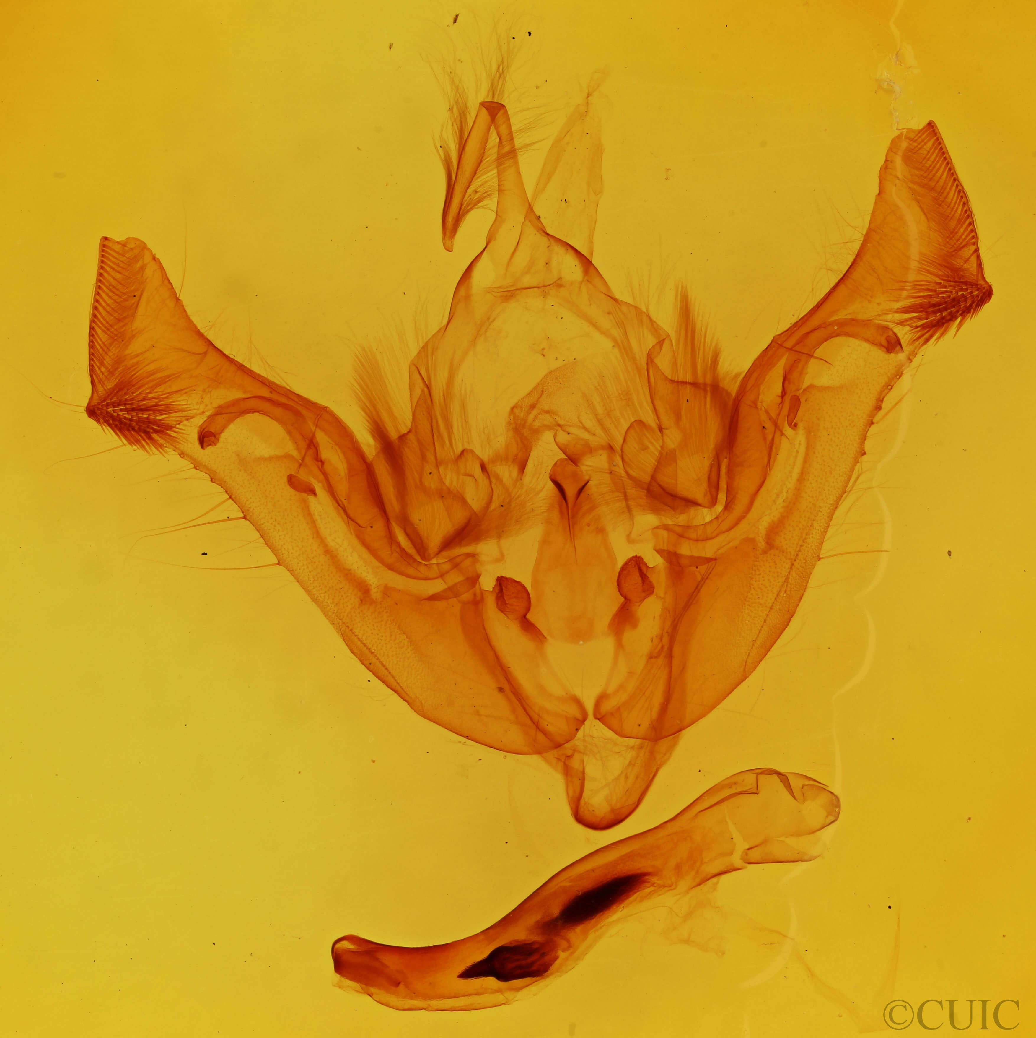 genitalia view of adult Aporophyla nigra