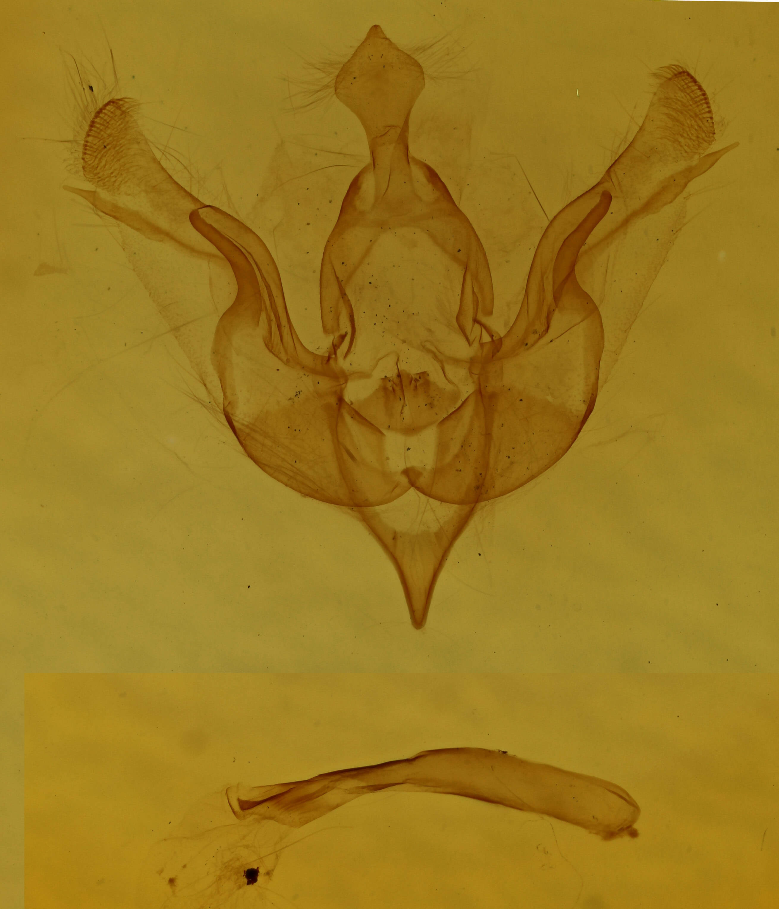 genitalia view of adult Brachylomia elda