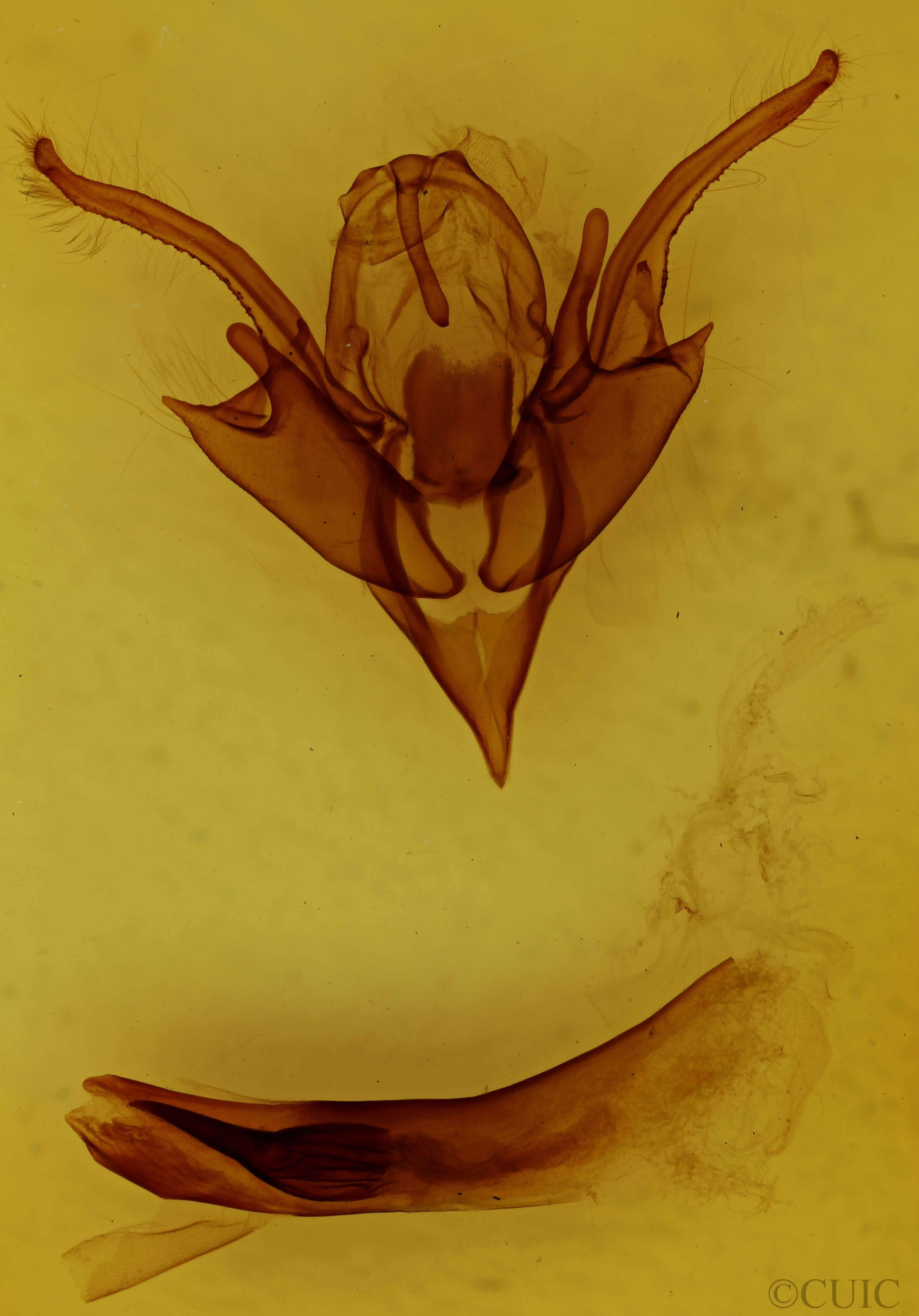 genitalia view of adult Chaetaglaea tremula