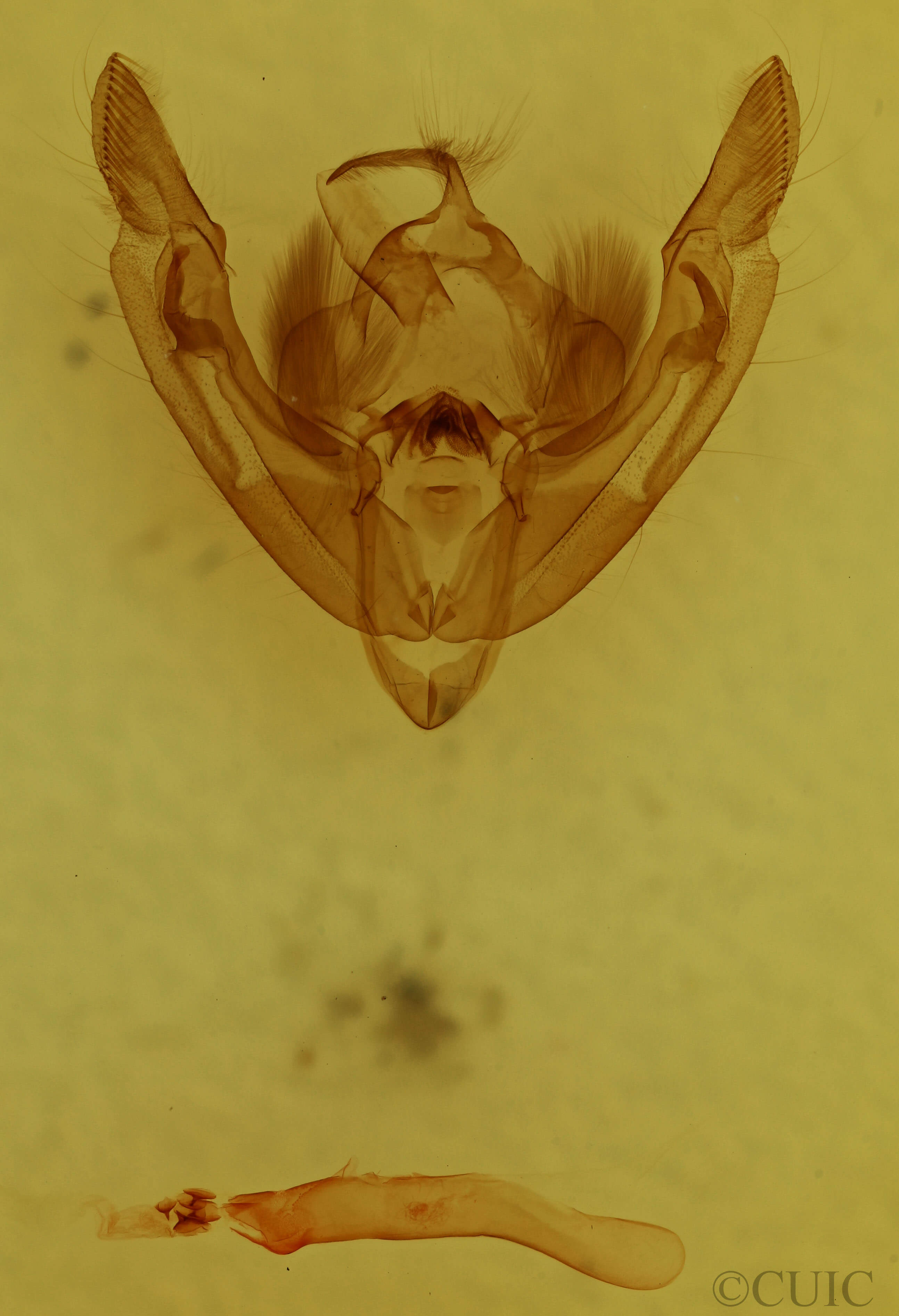 genitalia view of adult Ipimorpha pleonectusa