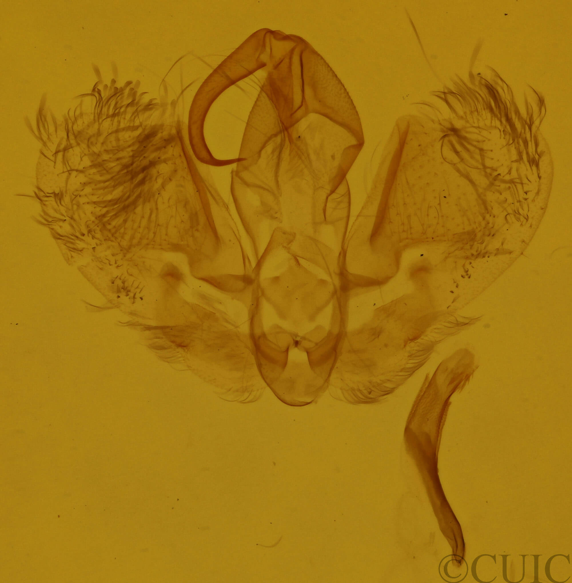 genitalia view of adult Hypena scabra