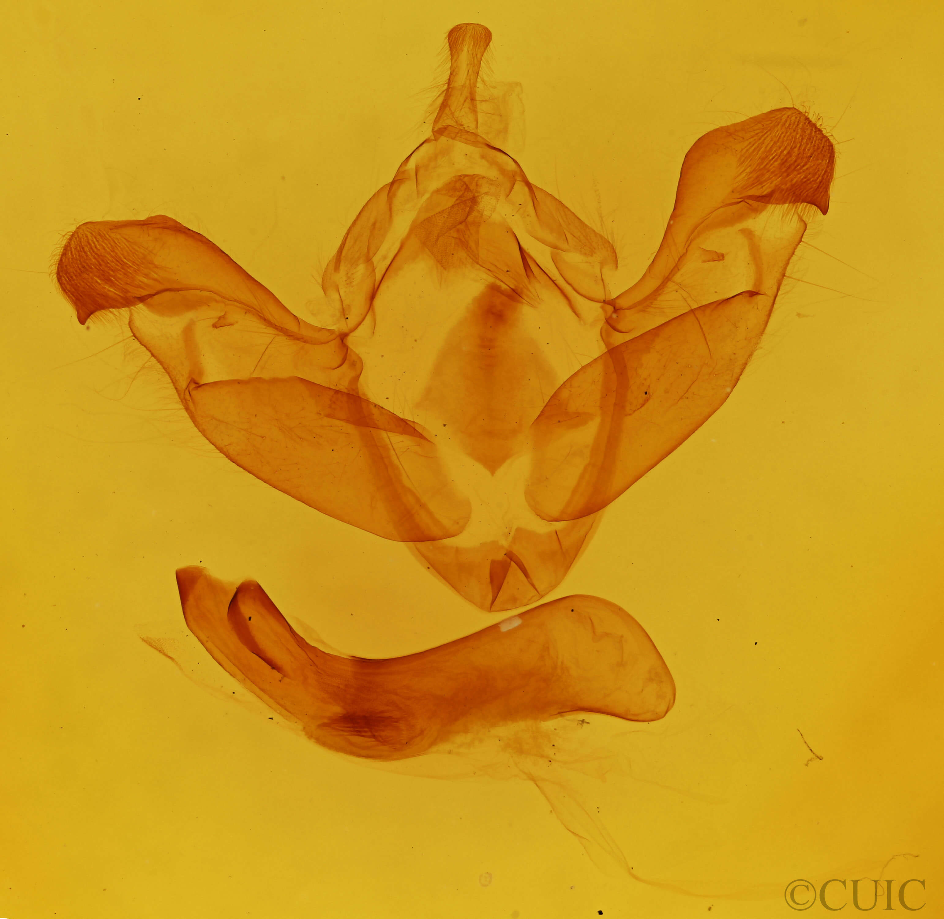 genitalia view of adult Polymixis xanthomista