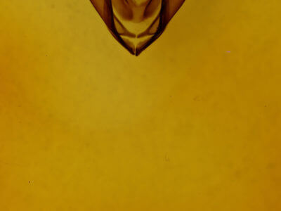 genitalia view of adult Zale