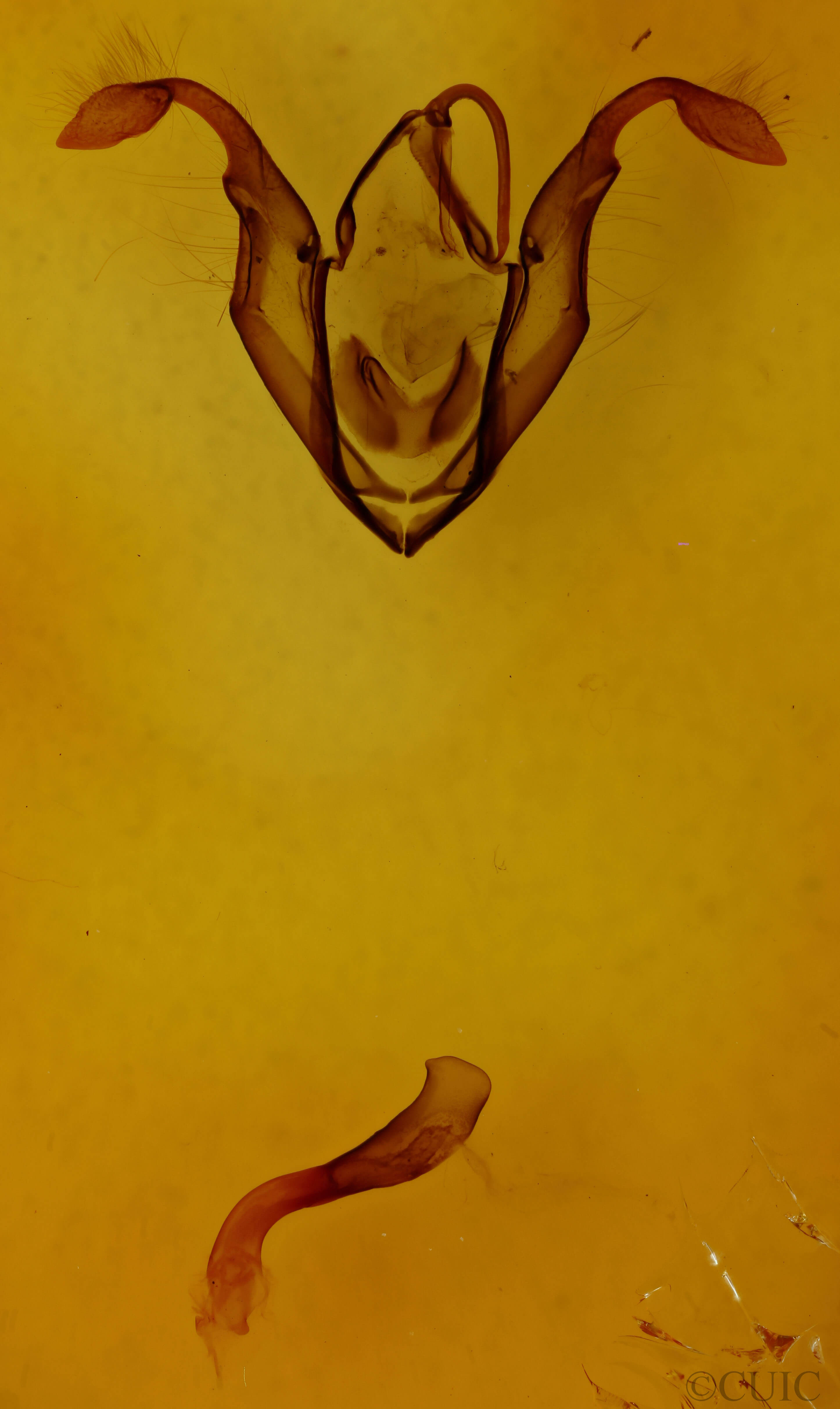 genitalia view of adult Zale