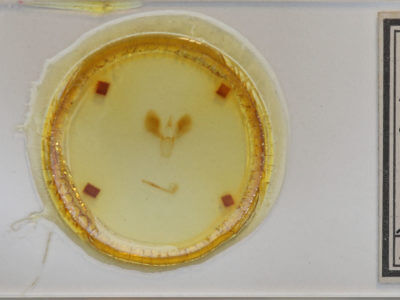 slide view of adult Alabama argillacea