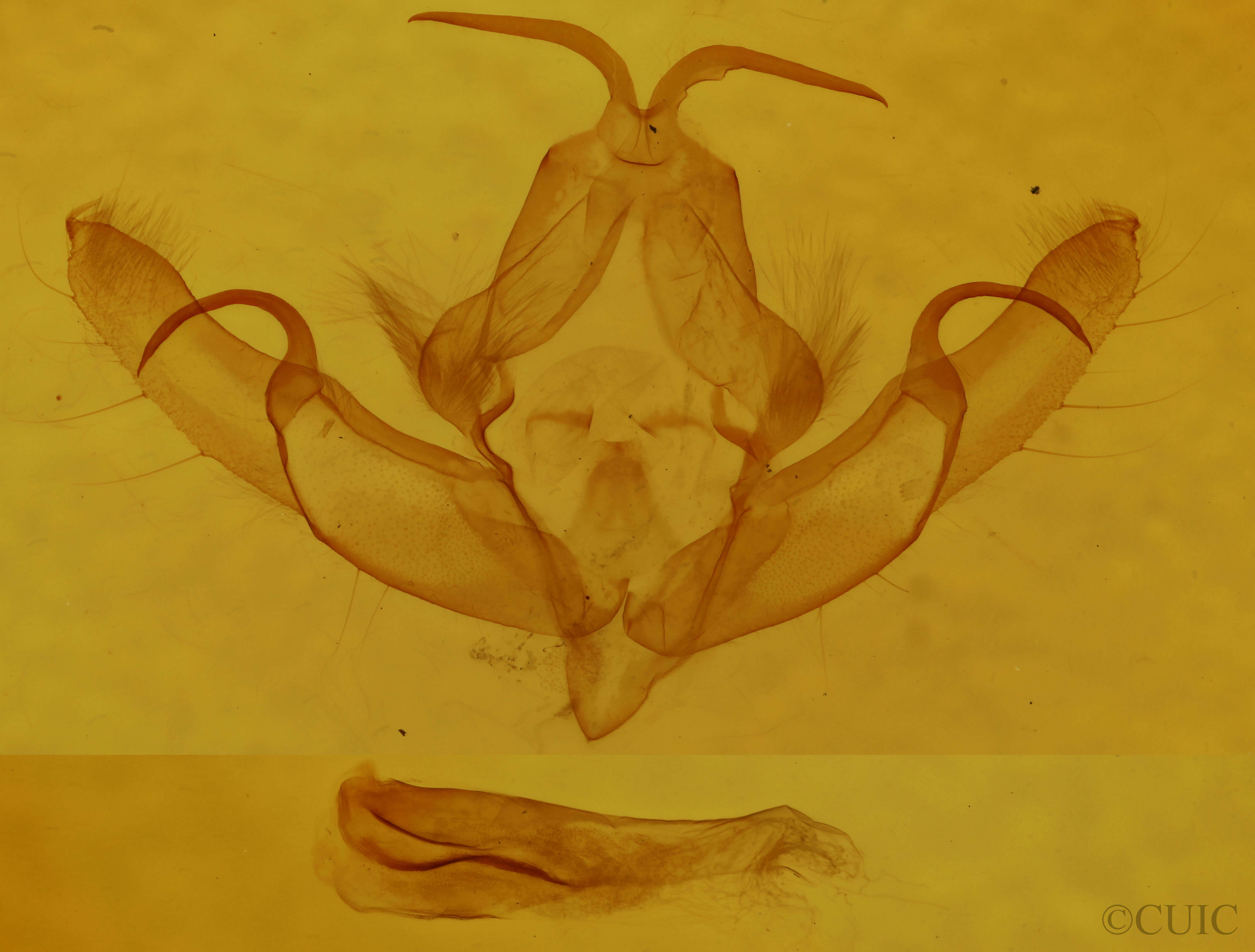 genitalia view of adult Anathix puta