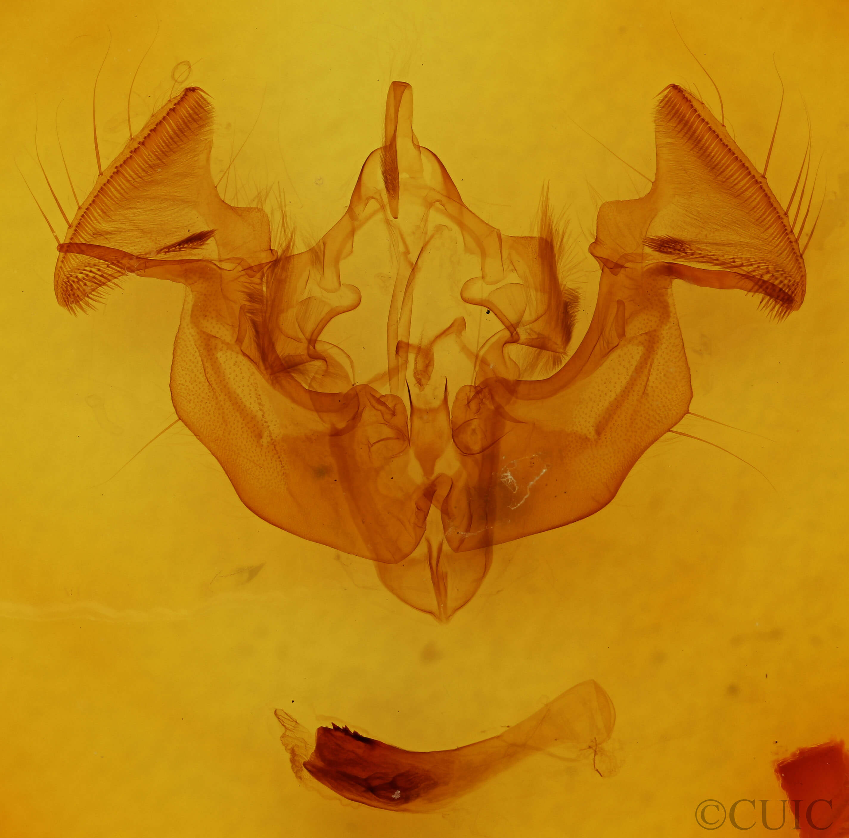 genitalia view of adult Apamea dubitans