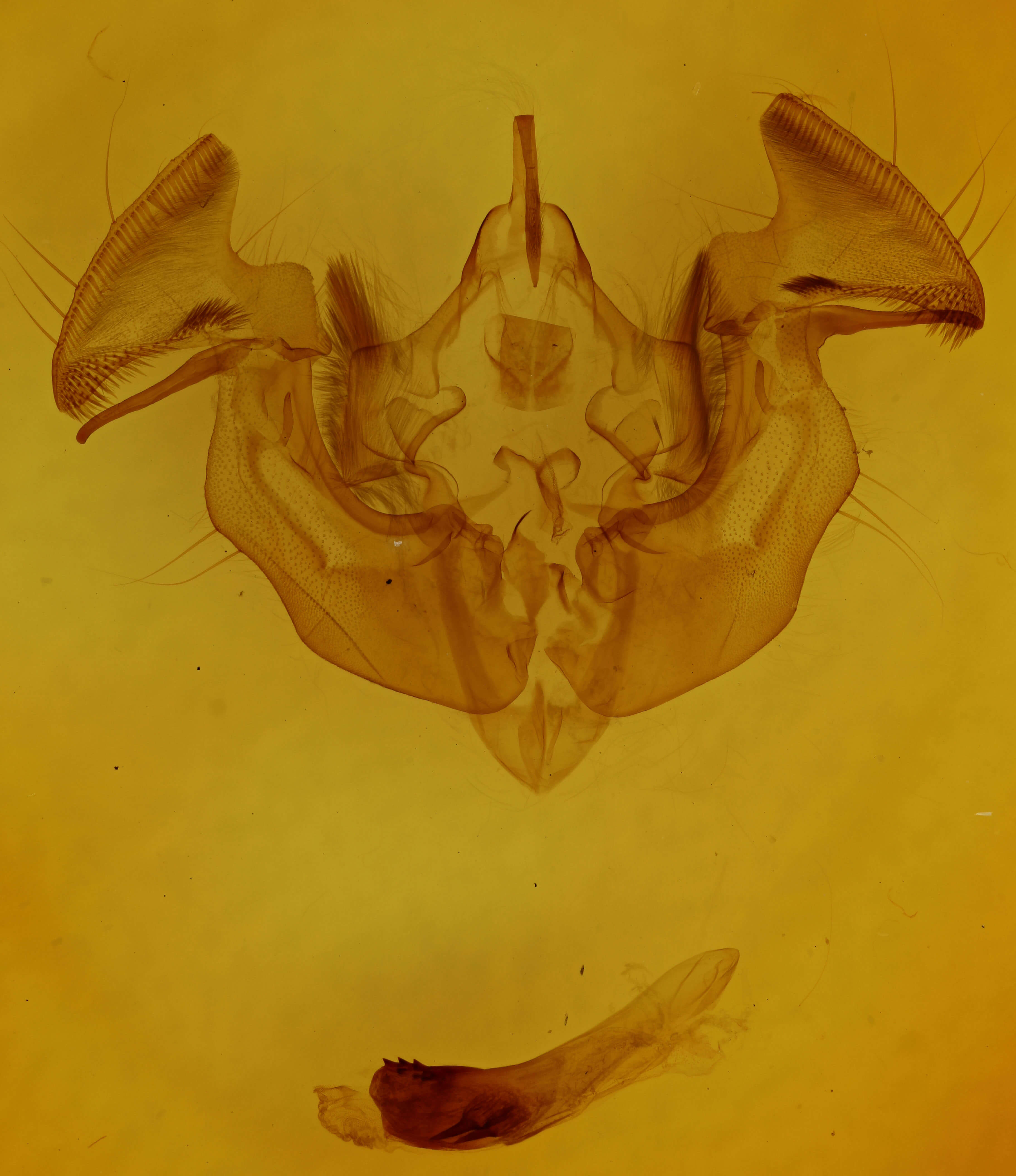 genitalia view of adult Apamea dubitans