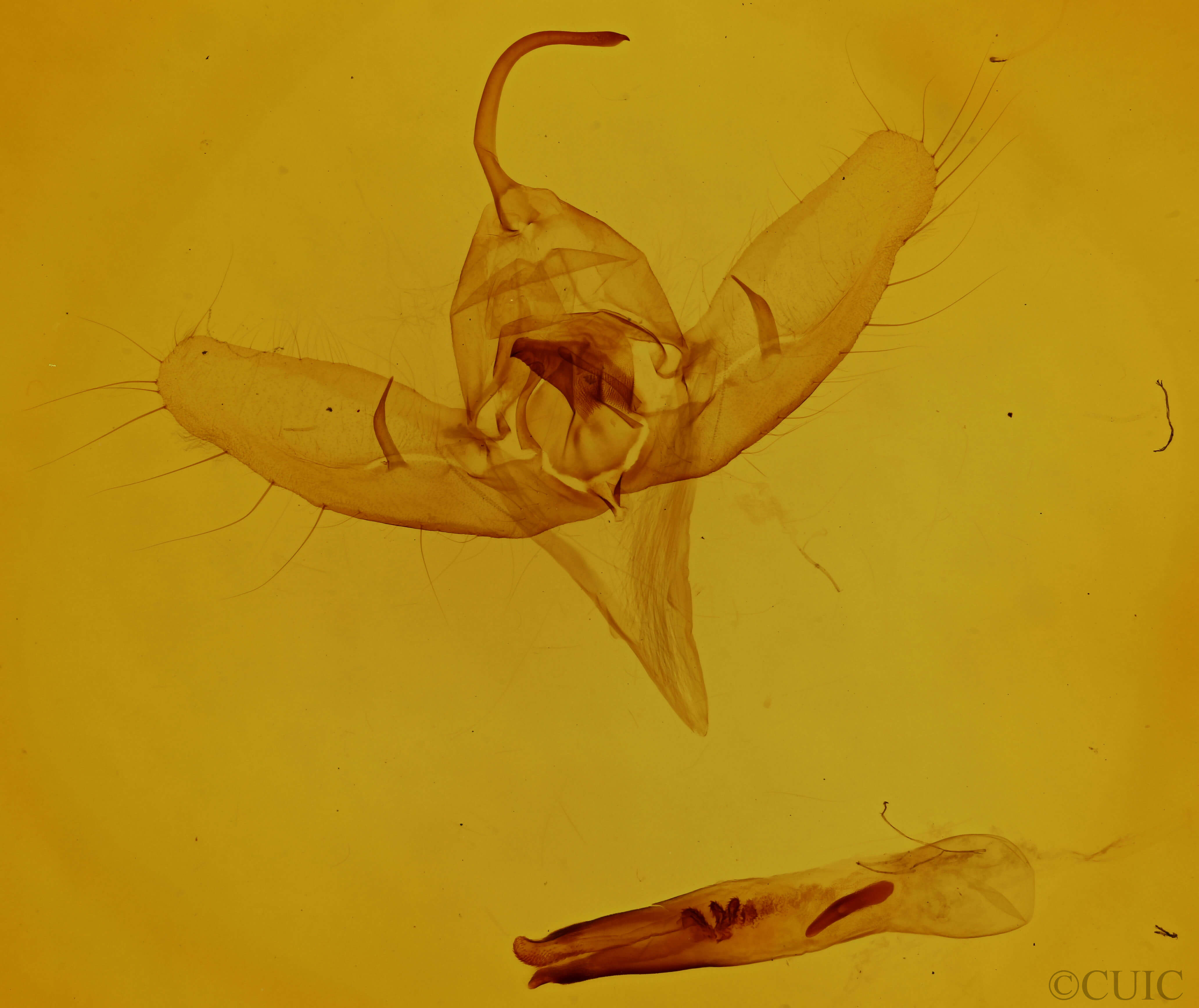 genitalia view of adult Diachrysia balluca