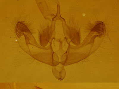 genitalia view of adult Dicycla oo