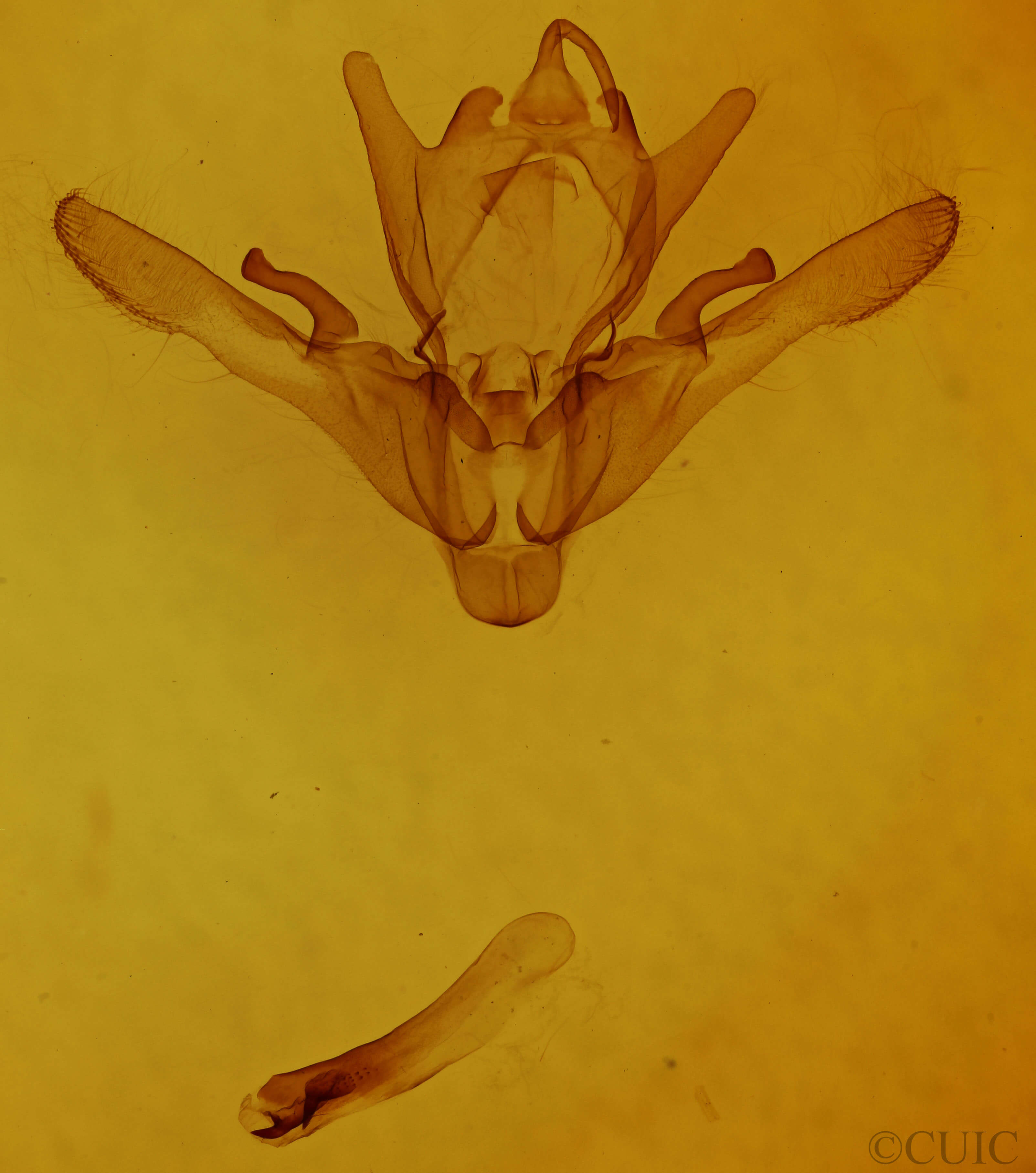 genitalia view of adult Enargia decolor