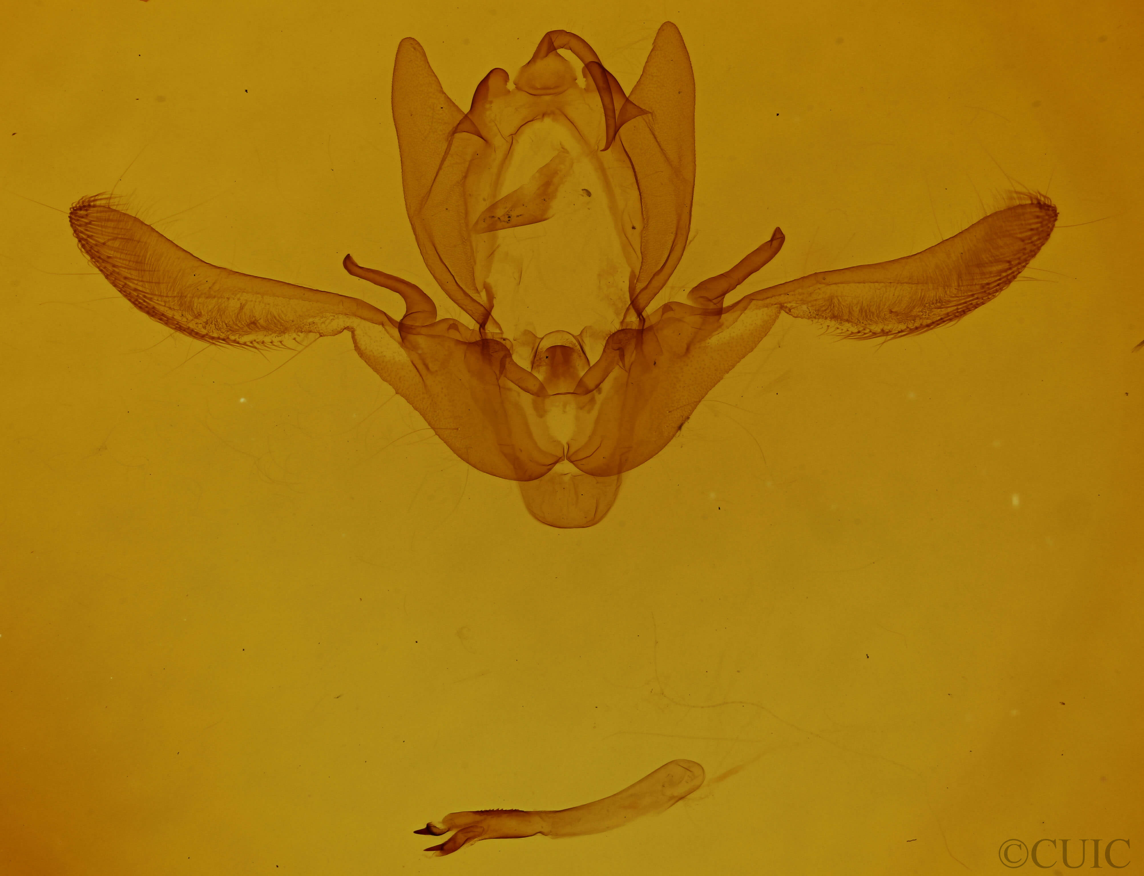 genitalia view of adult Enargia infumata