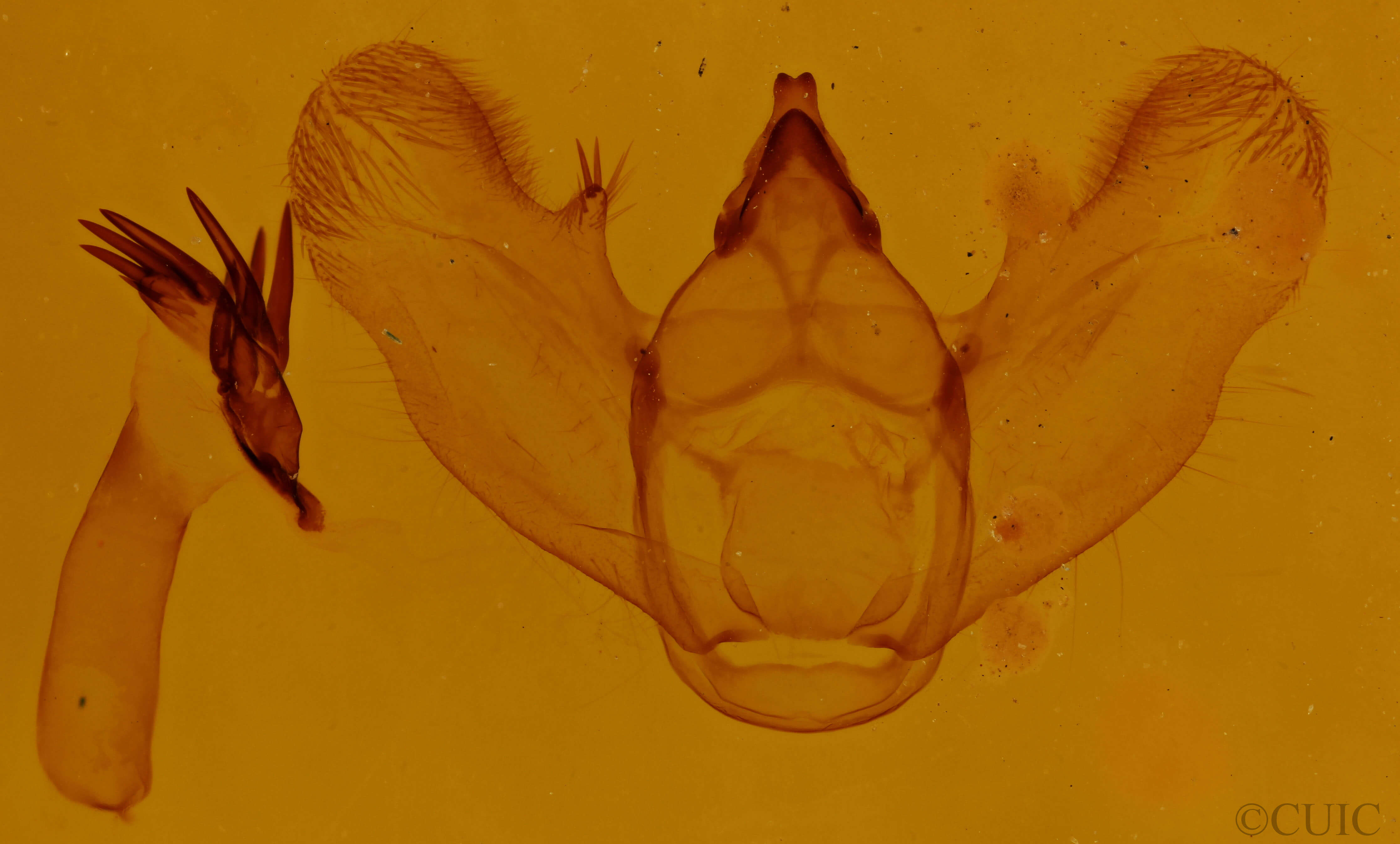 genitalia view of adult Epimecis hortaria
