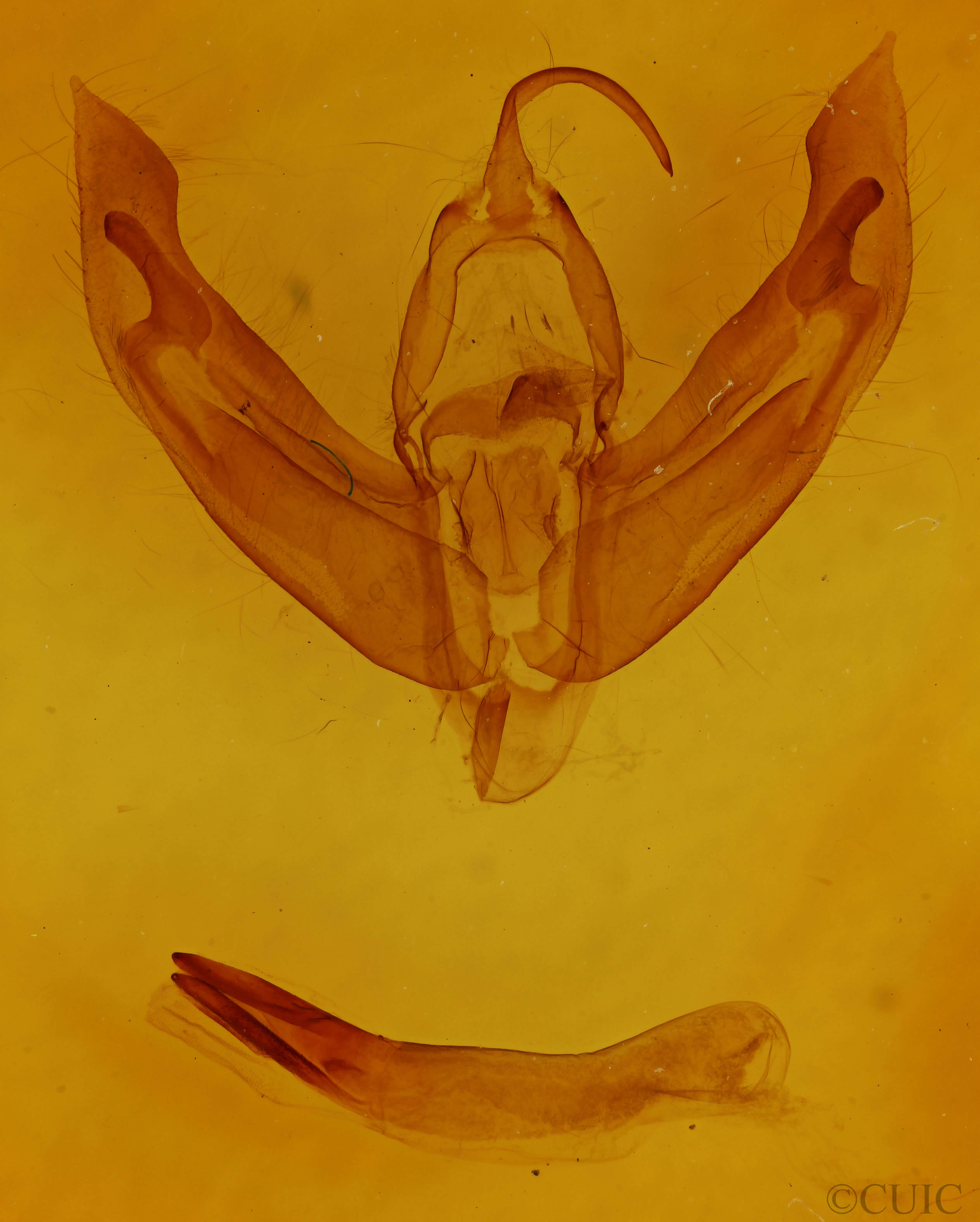 genitalia view of adult Eurois astricta