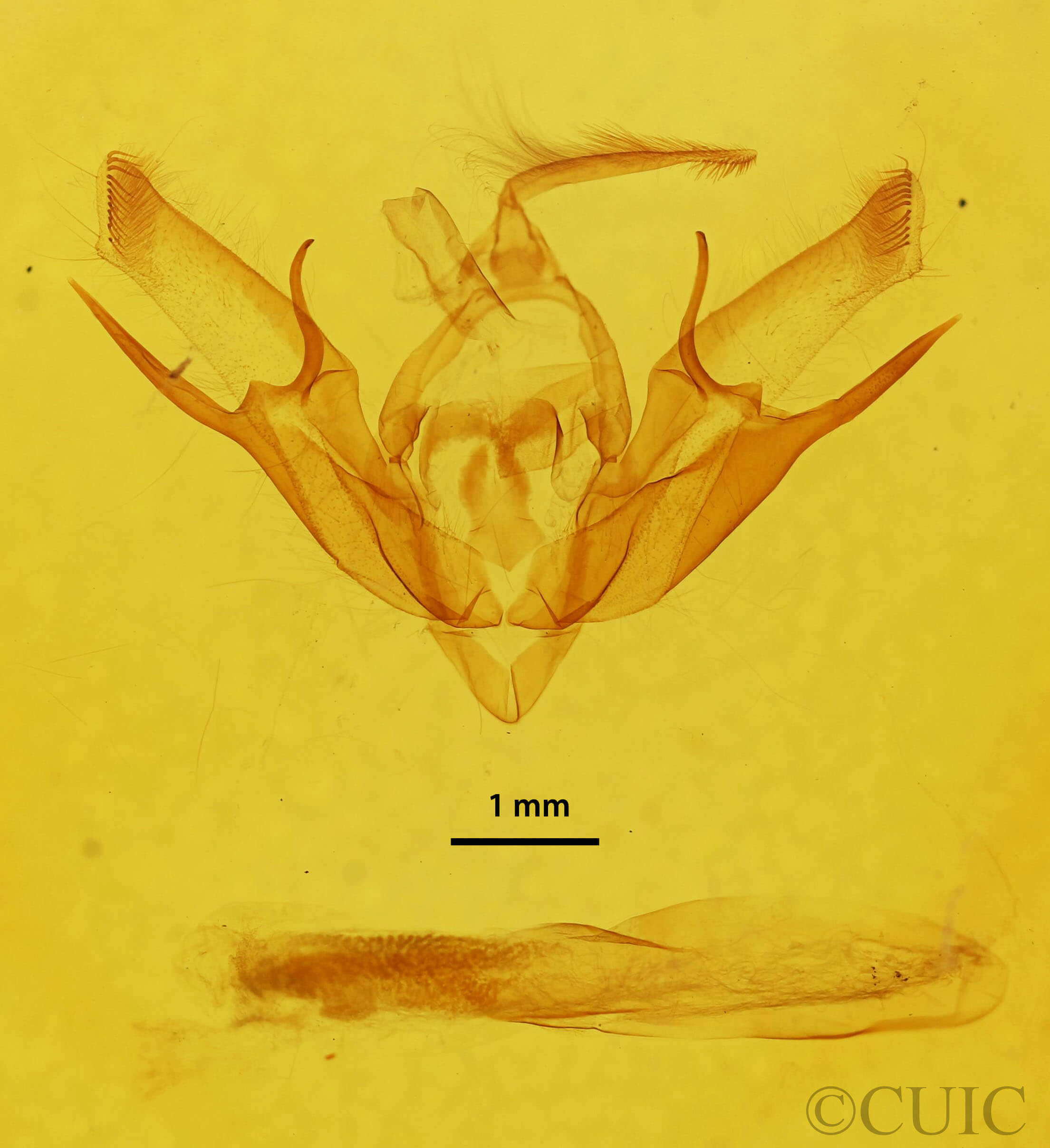 genitalia view of adult Euxoa bostoniensis