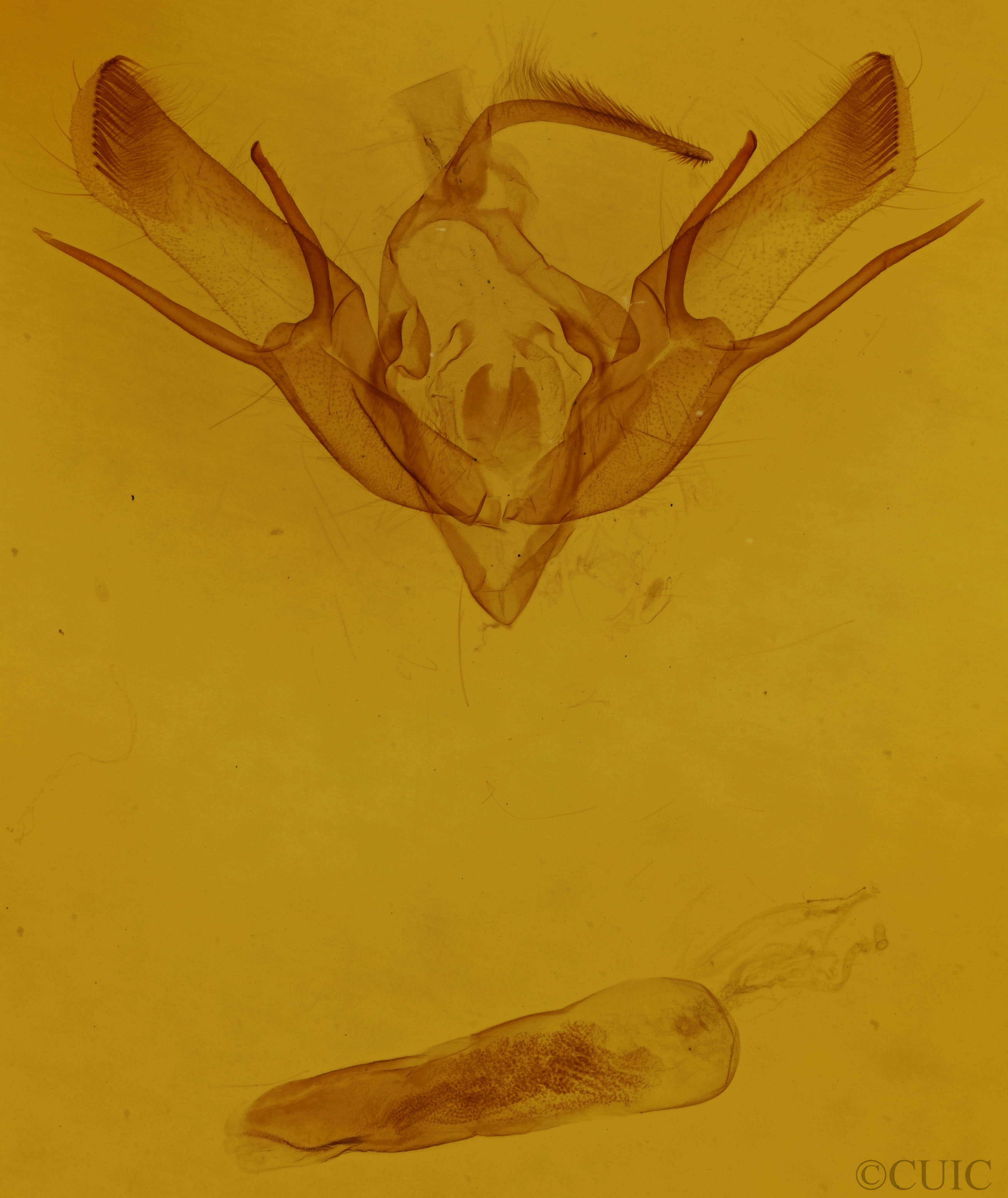 genitalia view of adult Euxoa redimicula