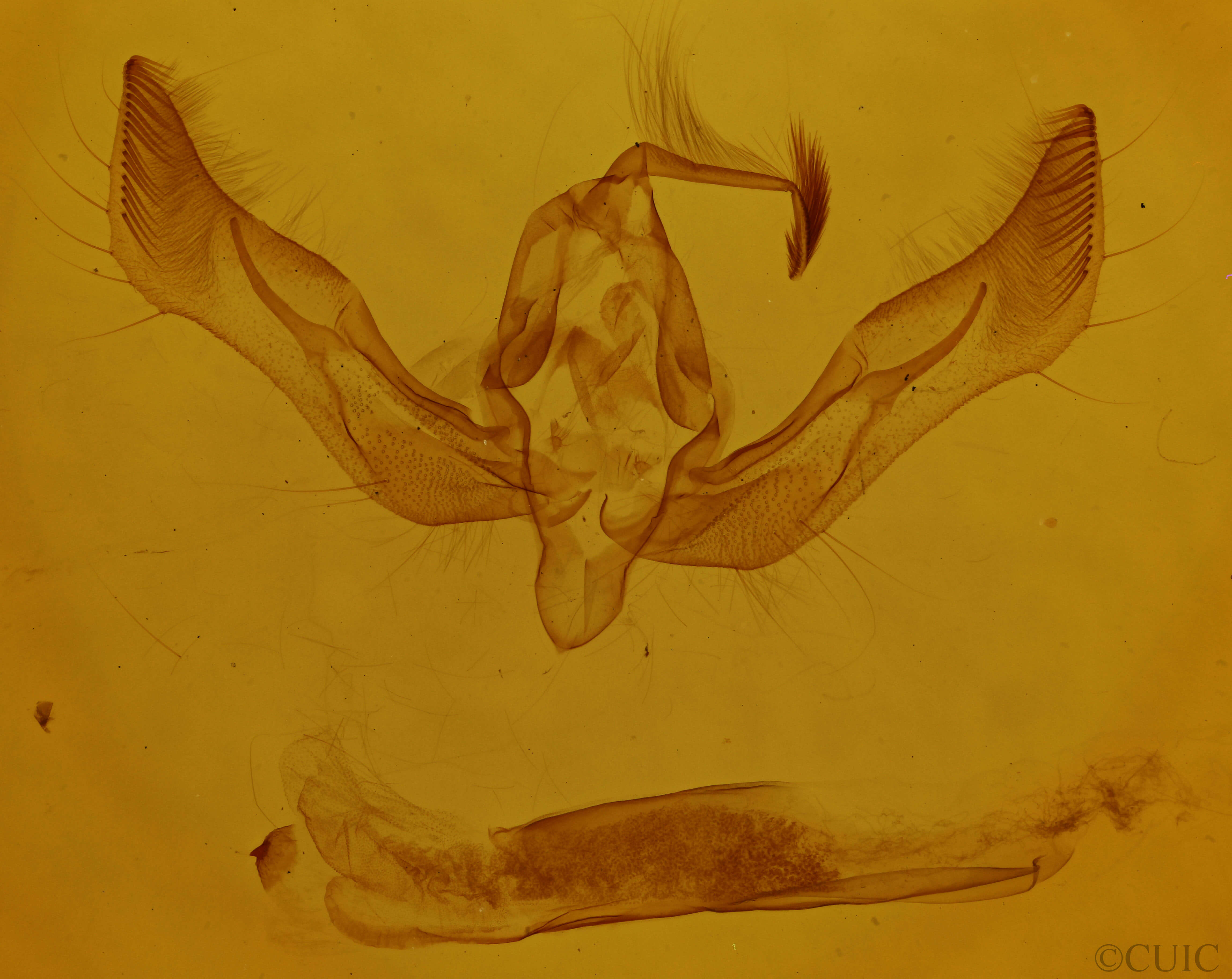 genitalia view of adult Feltia sp.