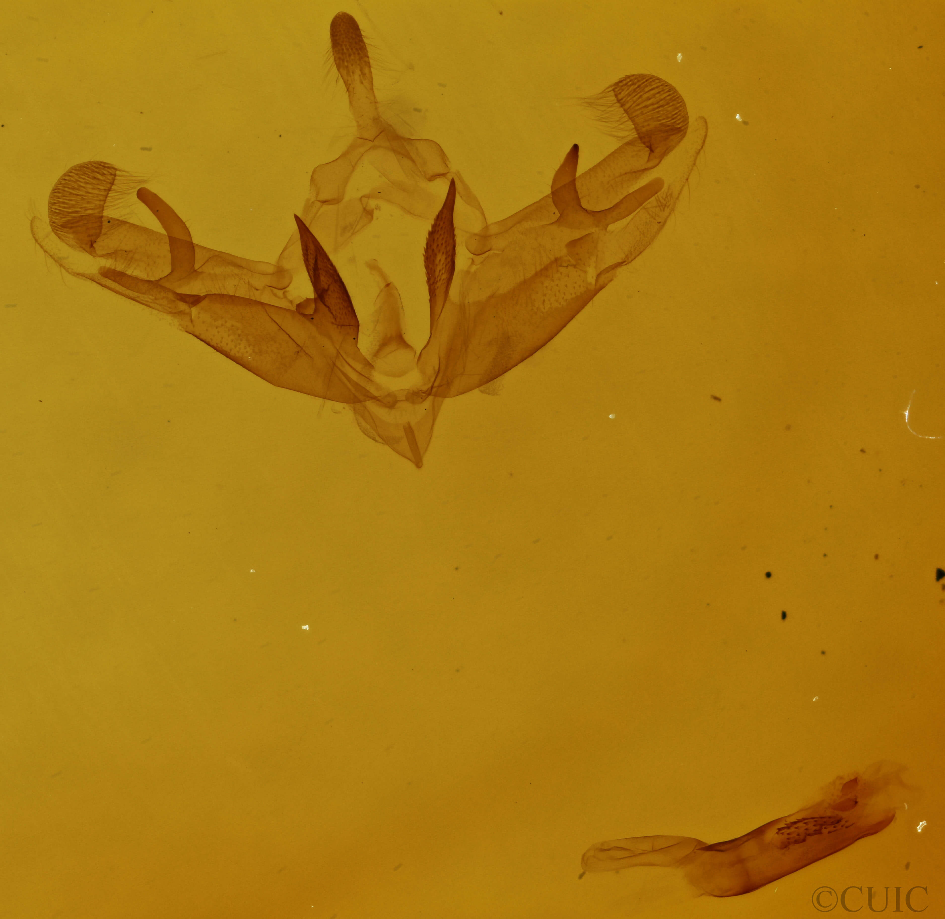 slide view of adult Galgula partita