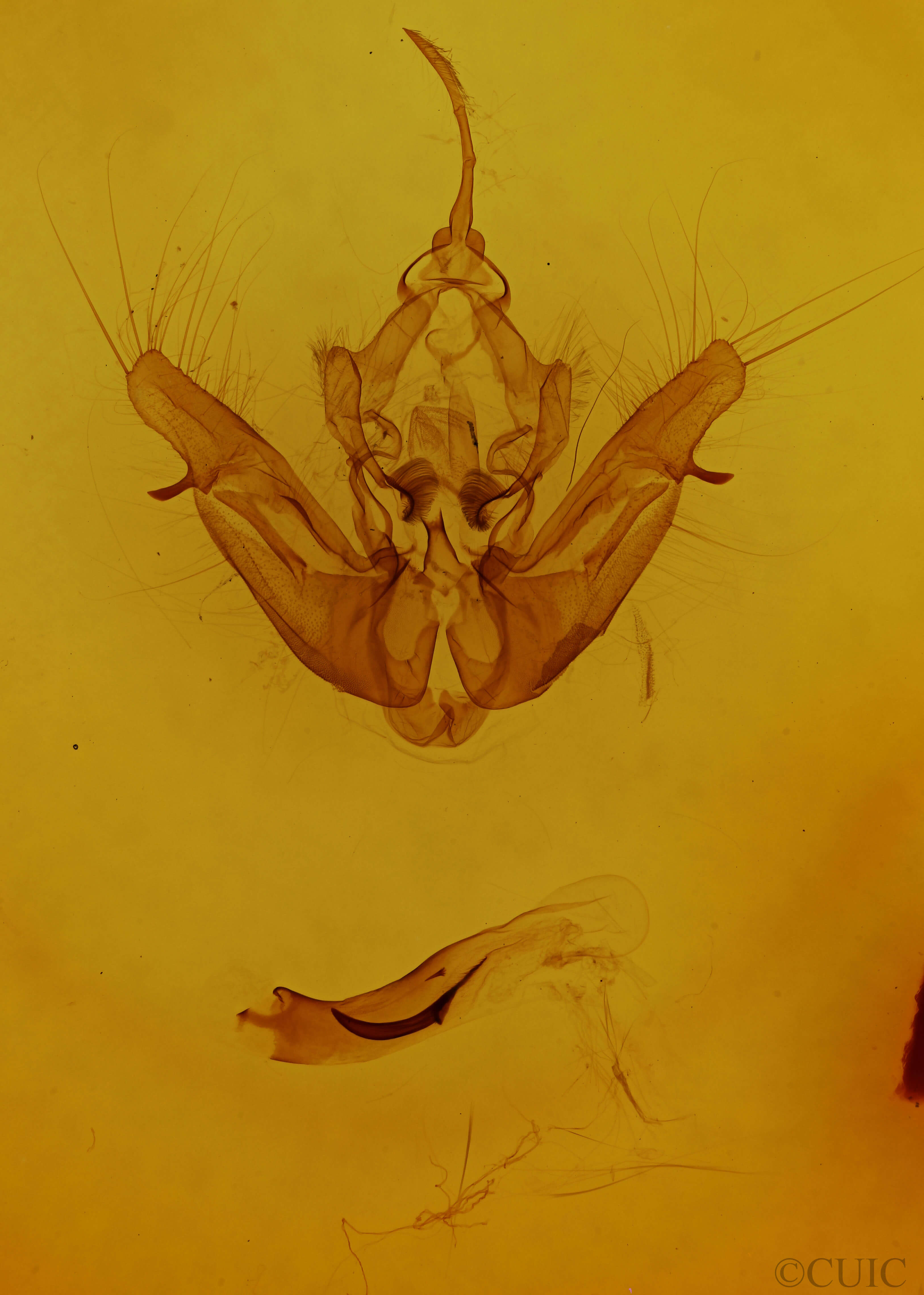 genitalia view of adult Helotropha reniformis