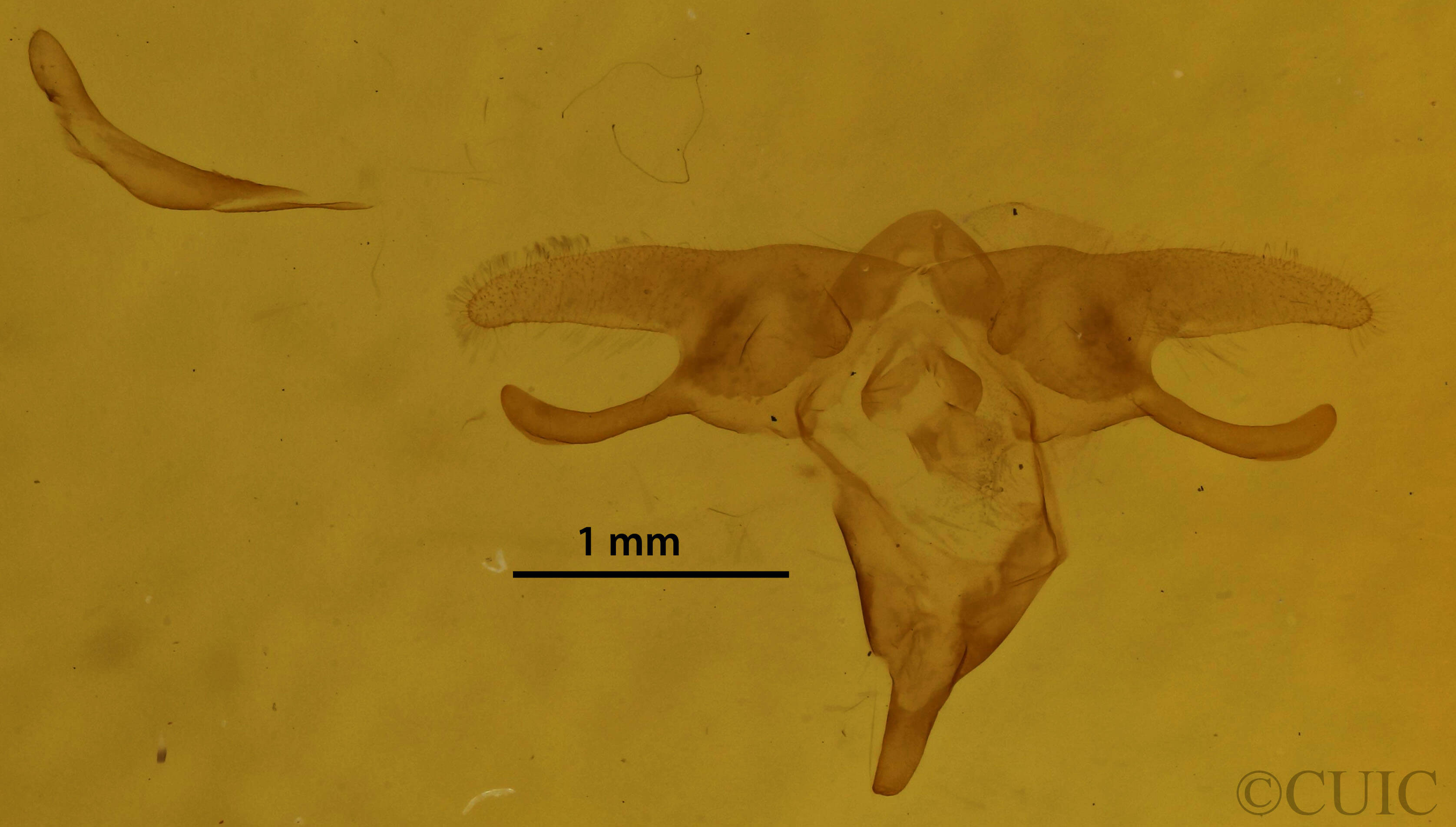 genitalia view of adult Orgyia leucostigma