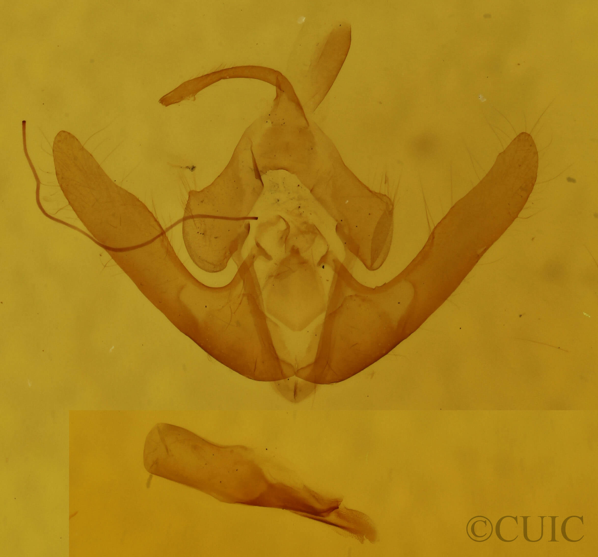 genitalia view of adult Deltote bankiana