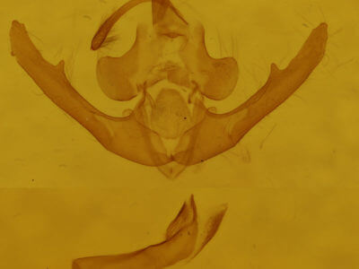 genitalia view of adult Deltote bellicula