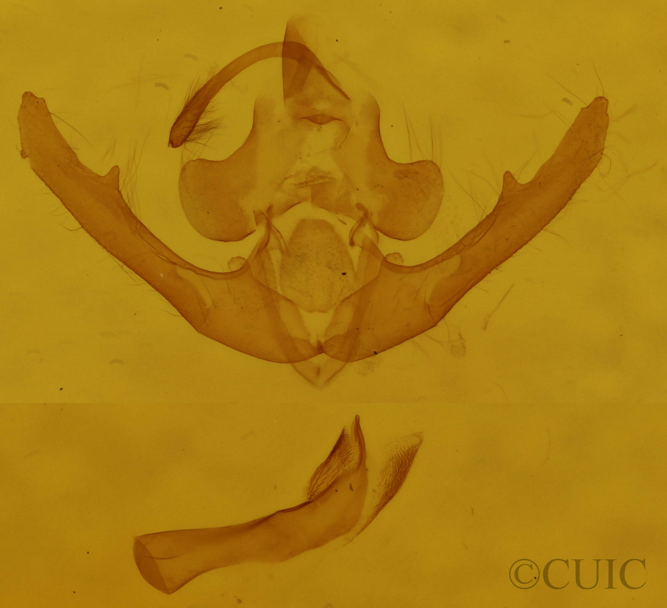 genitalia view of adult Deltote bellicula