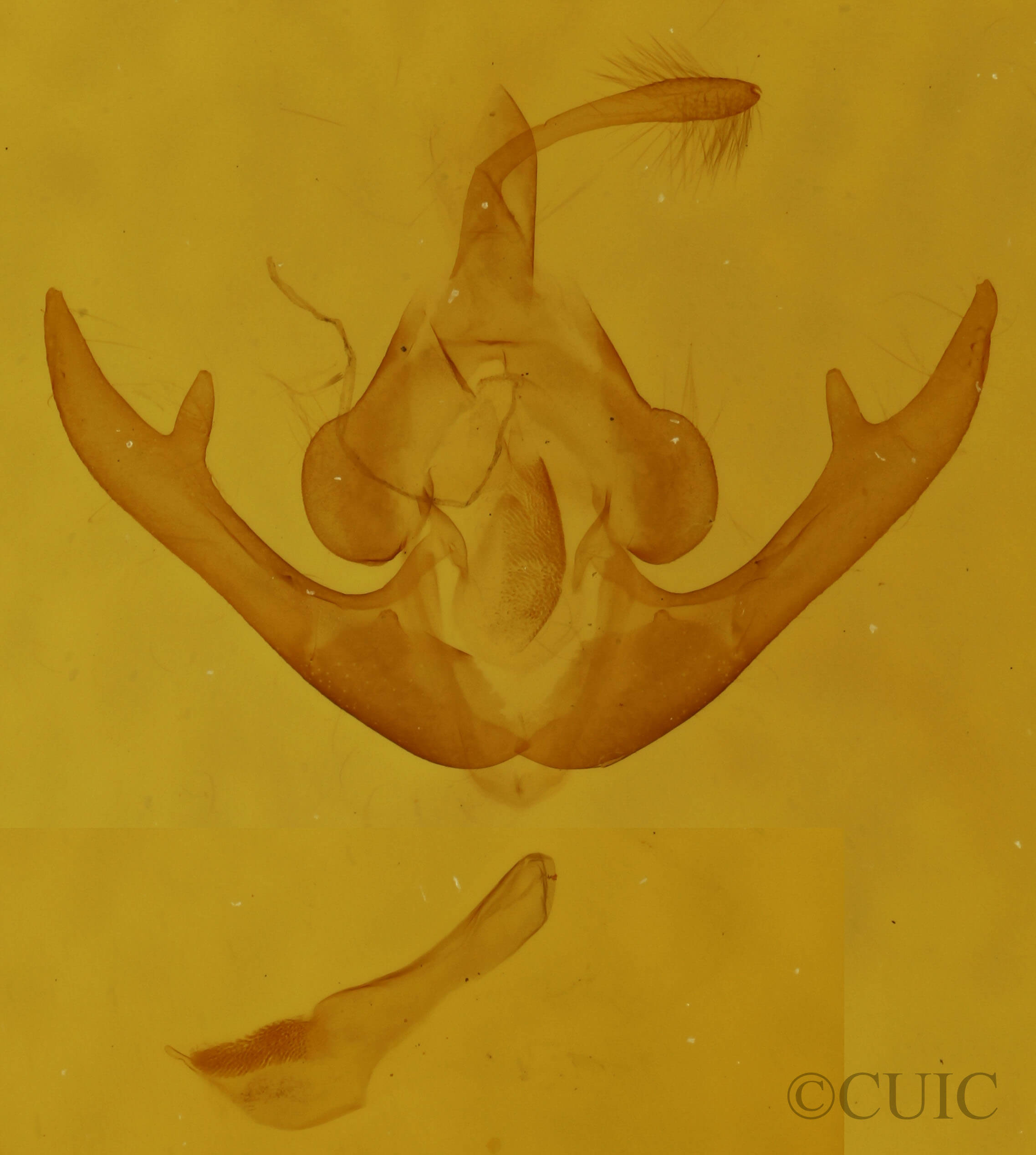genitalia view of adult Lithacodia uncula