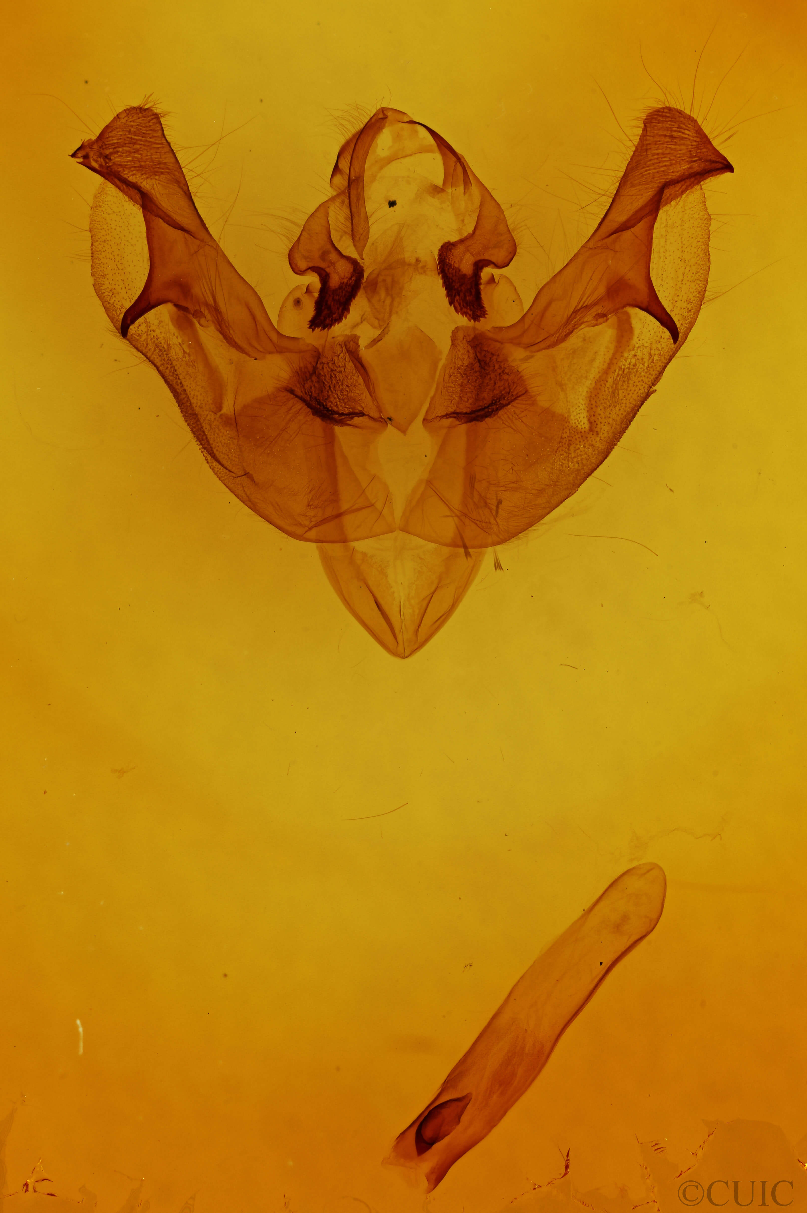 genitalia view of adult Macronoctua onusta