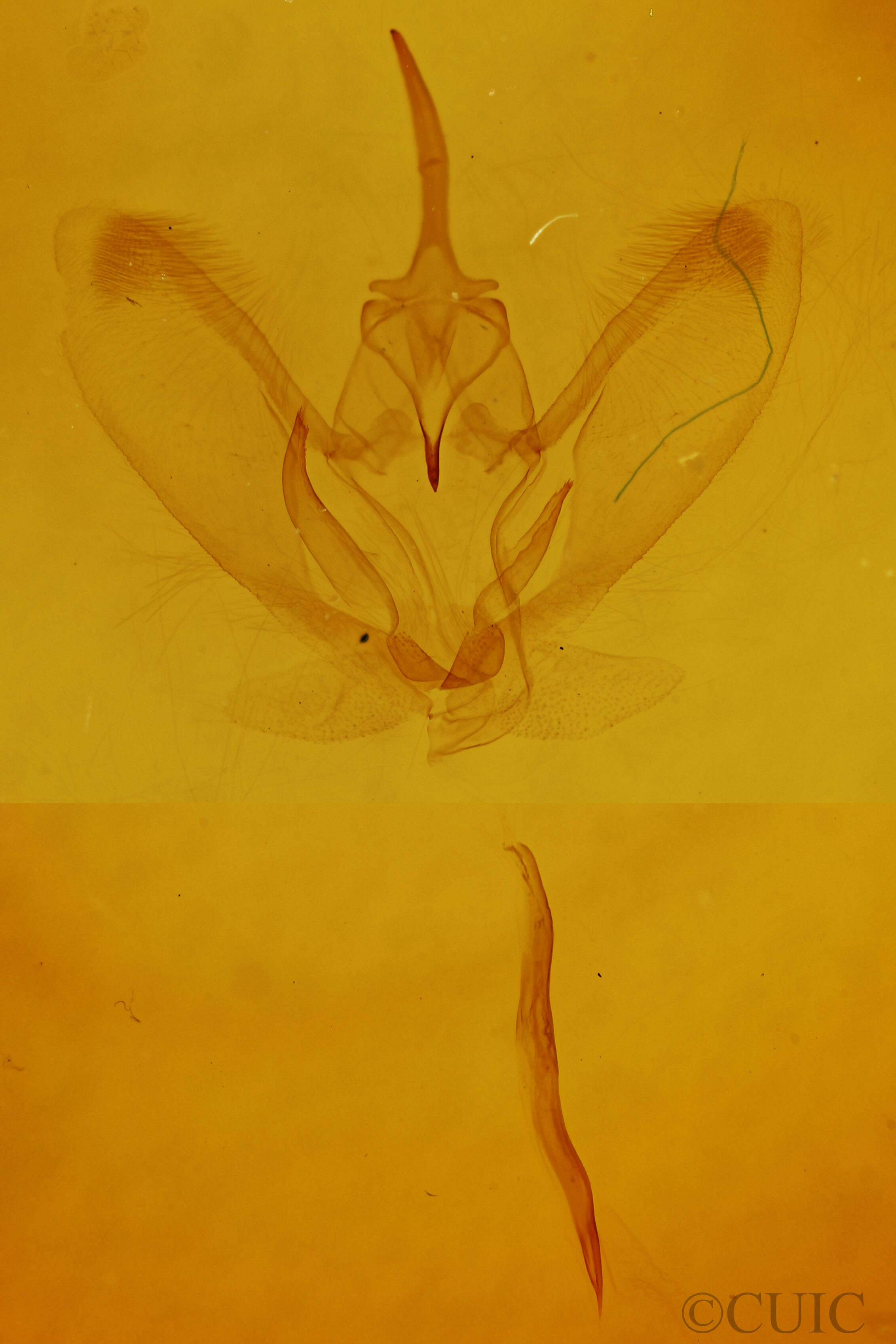 genitalia view of adult Metarranthis angularia
