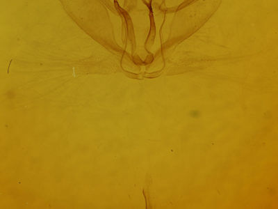 genitalia view of adult Metarranthis duaria