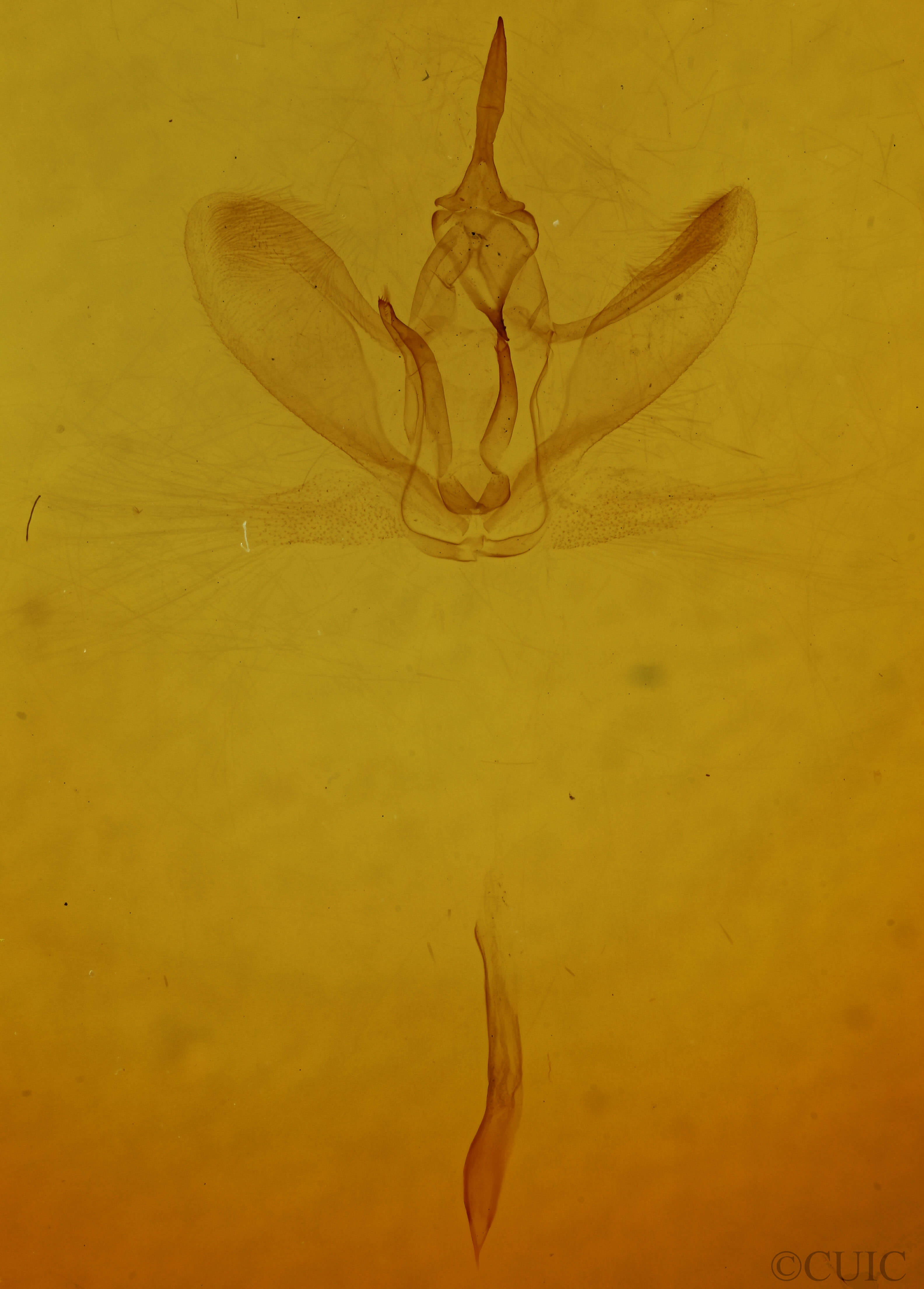 genitalia view of adult Metarranthis duaria