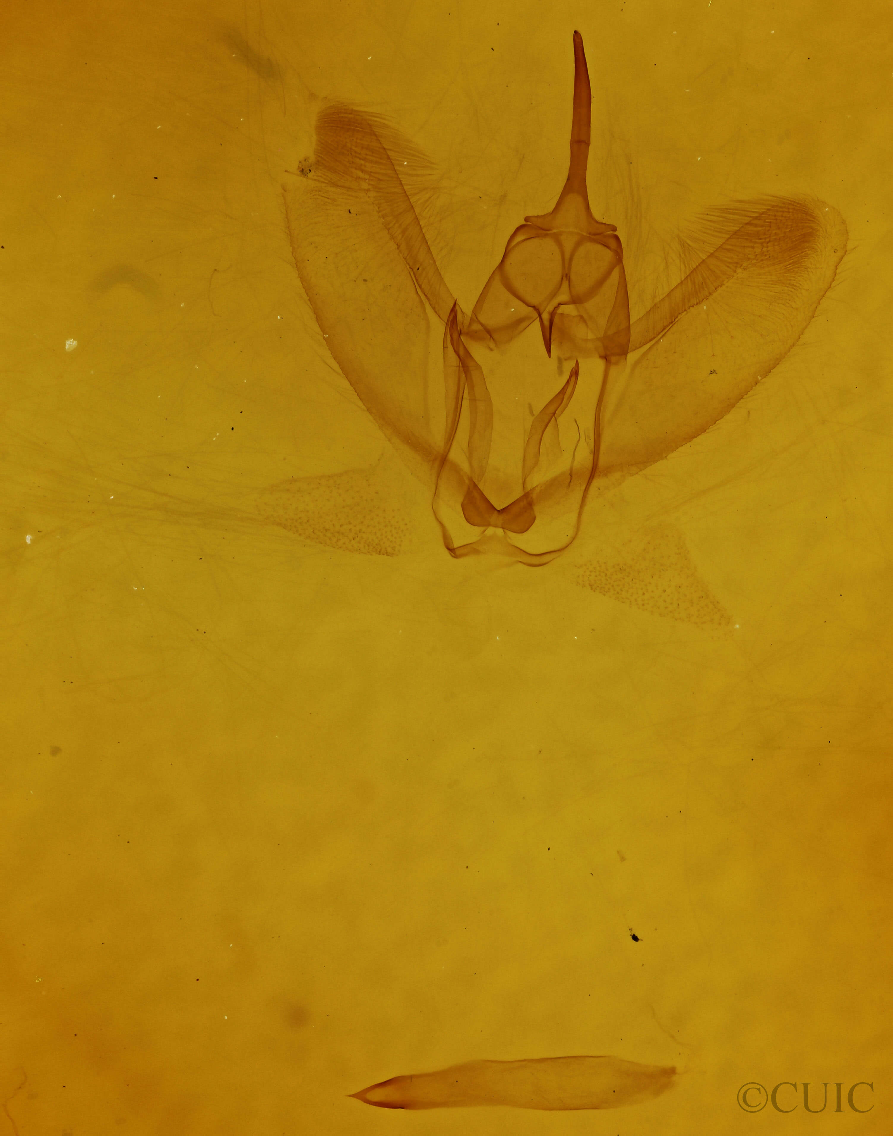 genitalia view of adult Metarranthis duaria