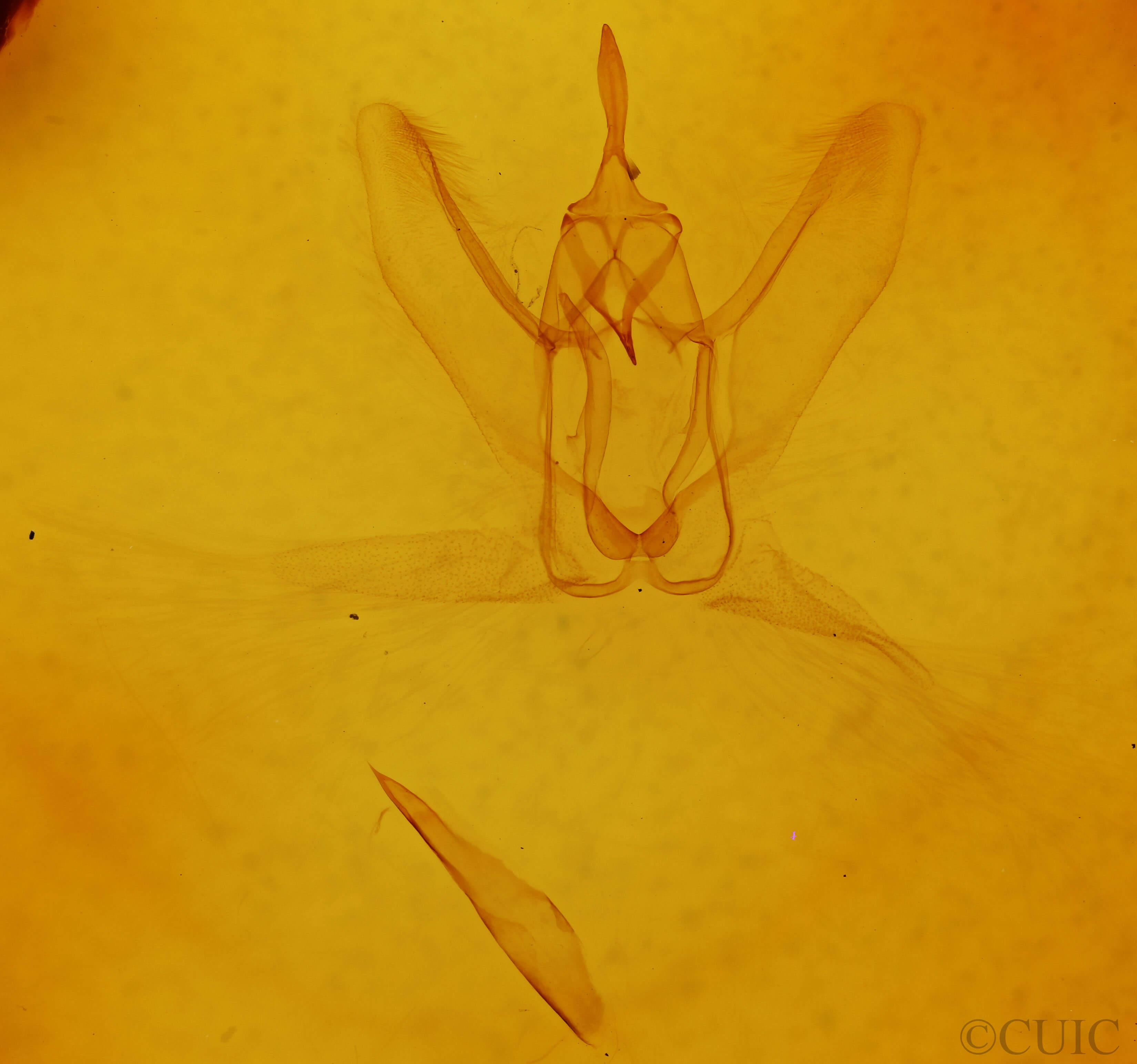 genitalia view of adult Metarranthis refractaria