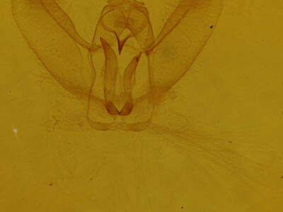 genitalia view of adult Metarranthis warneri